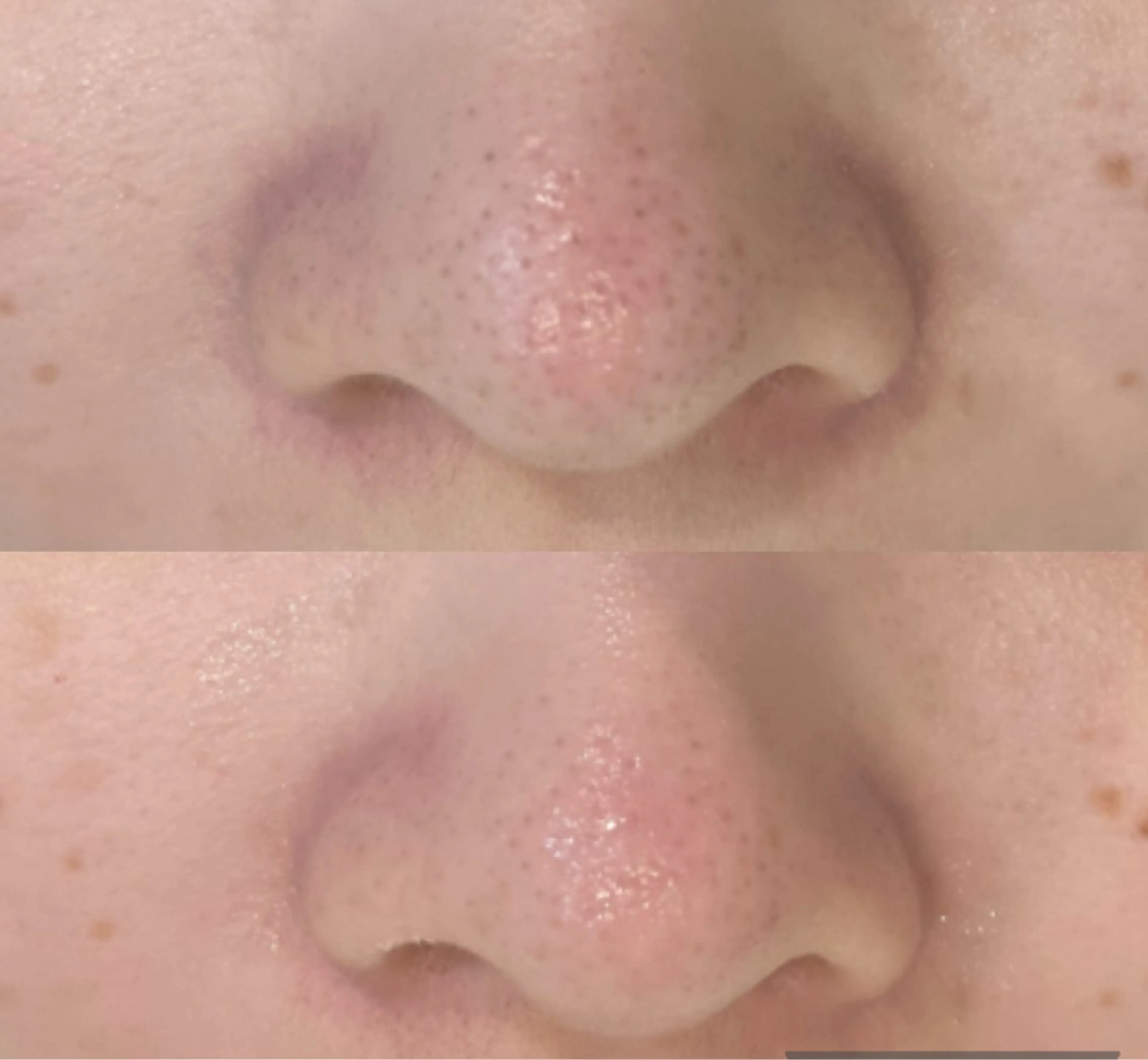 DeI'm   名古屋栄所属・小林 玲菜のエステ・リラクイメージ