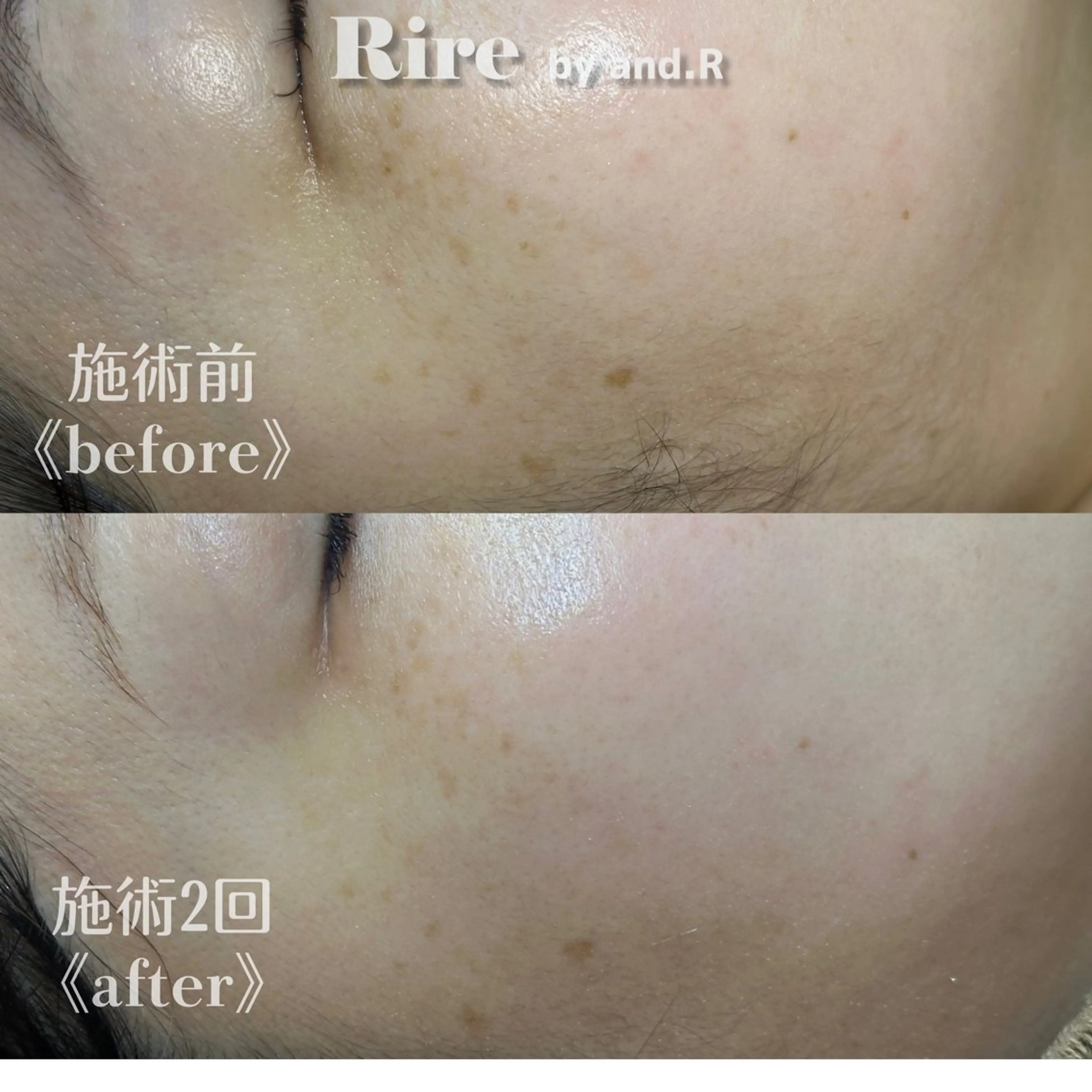 実方 梨々花のエステ・リラクイメージ