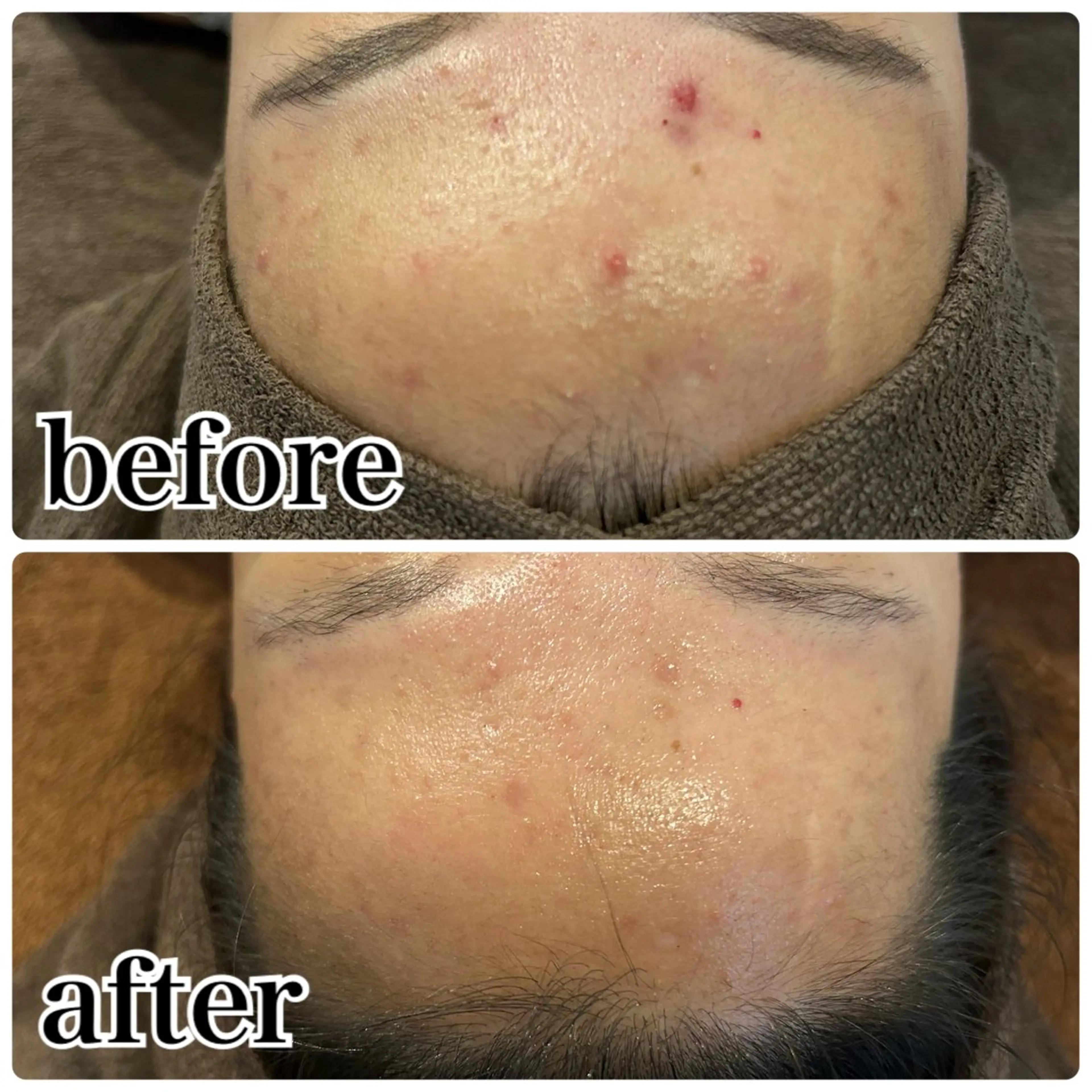 エステ Gemini 　MIKIのエステ・リラクイメージ