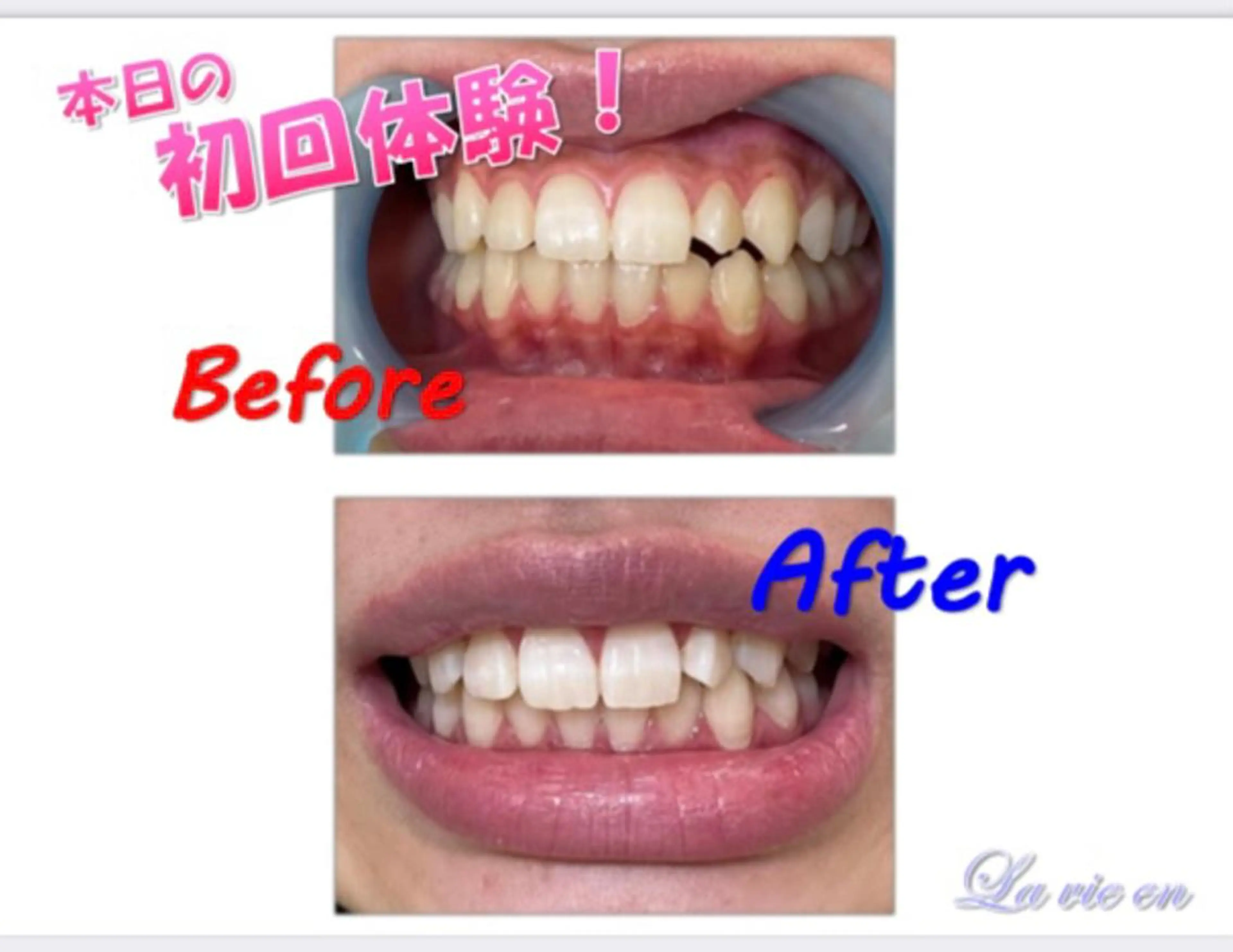 その他 セルフホワイトニングサロン　ラヴィアン所属・ホワイトニングサロン La vie enのその他イメージ