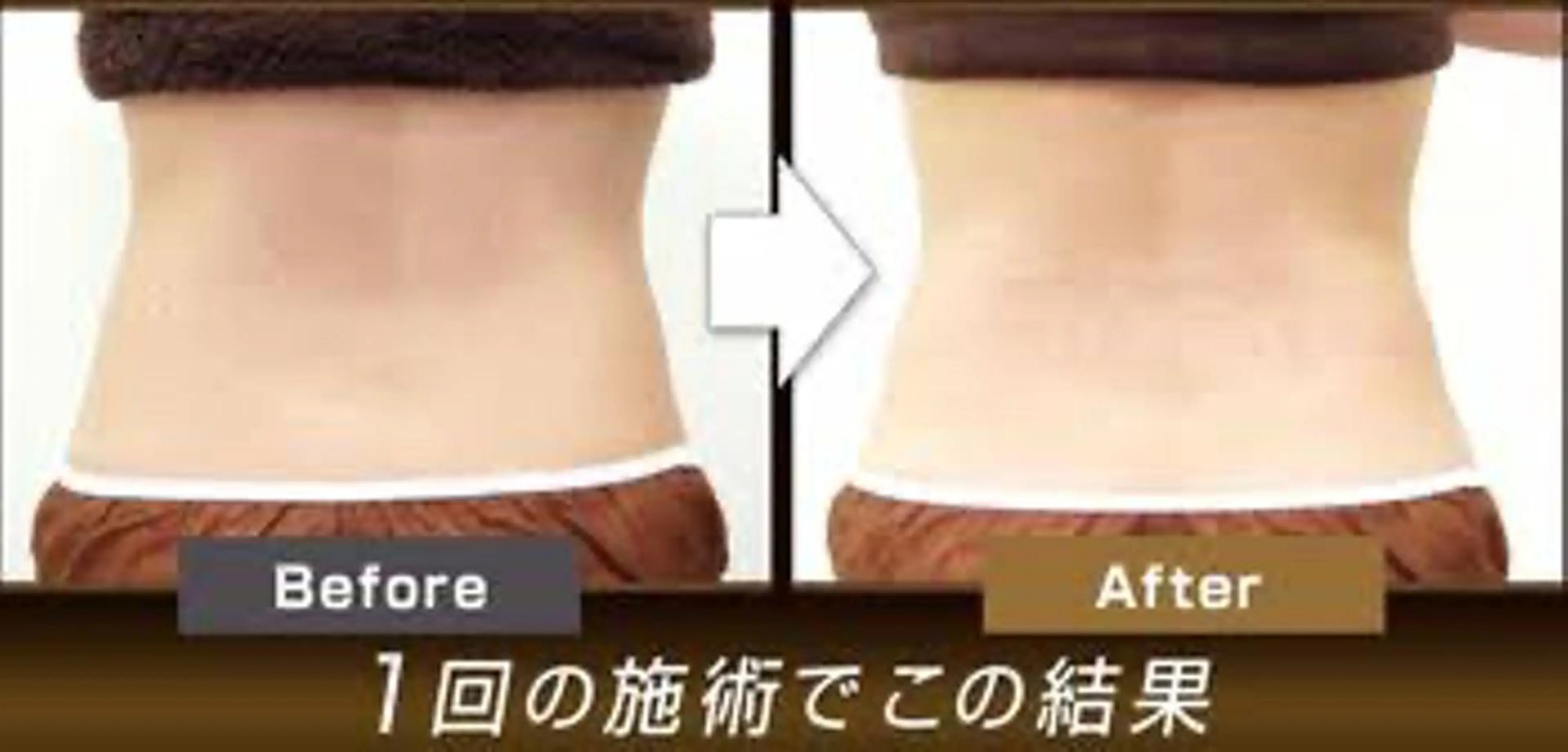 小顔矯正・美容鍼 美鍼堂のエステ・リラクイメージ