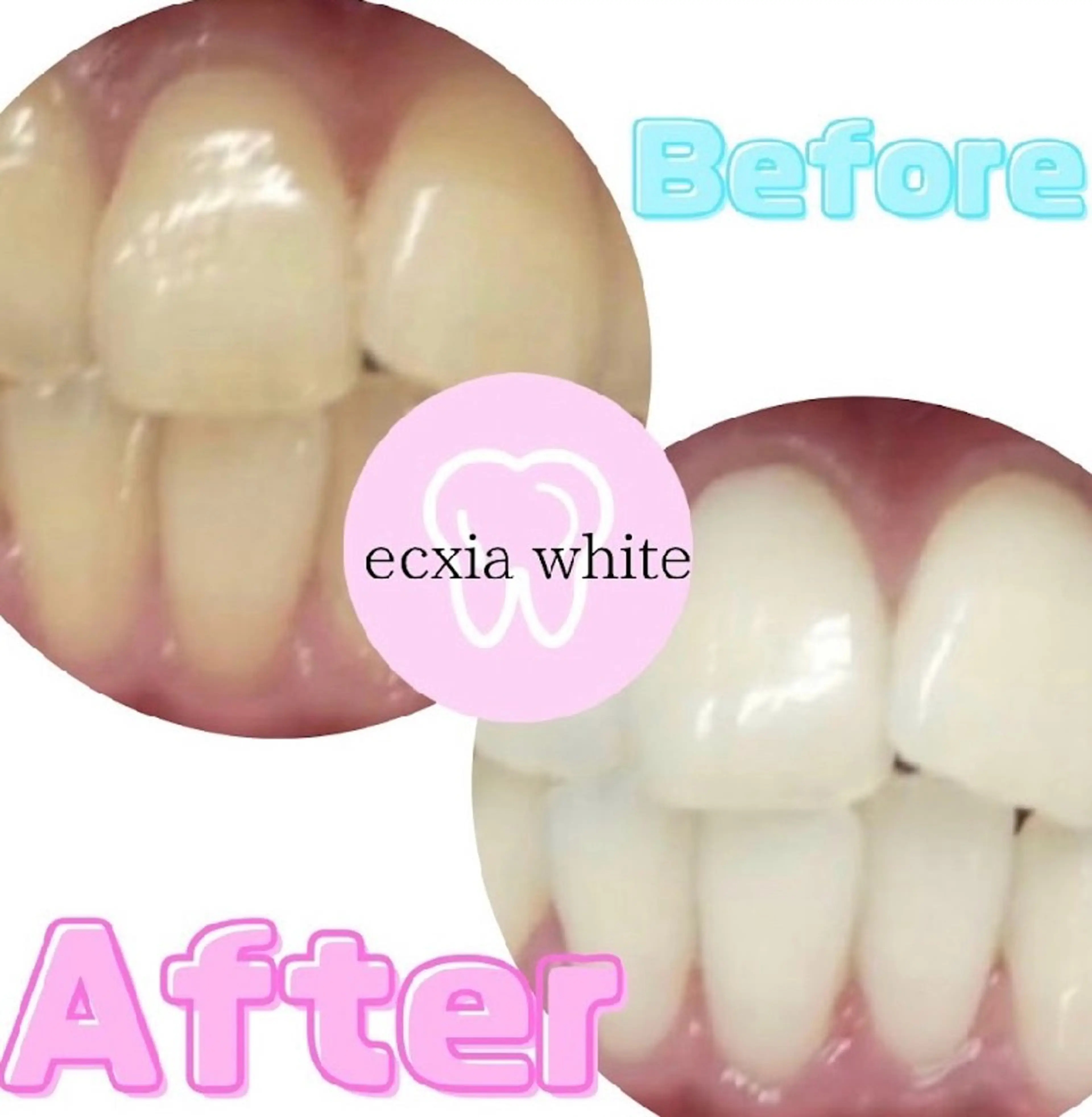 メンズ その他 エクシアホワイトニング草津店所属・nanami -ホワイトニングのその他イメージ