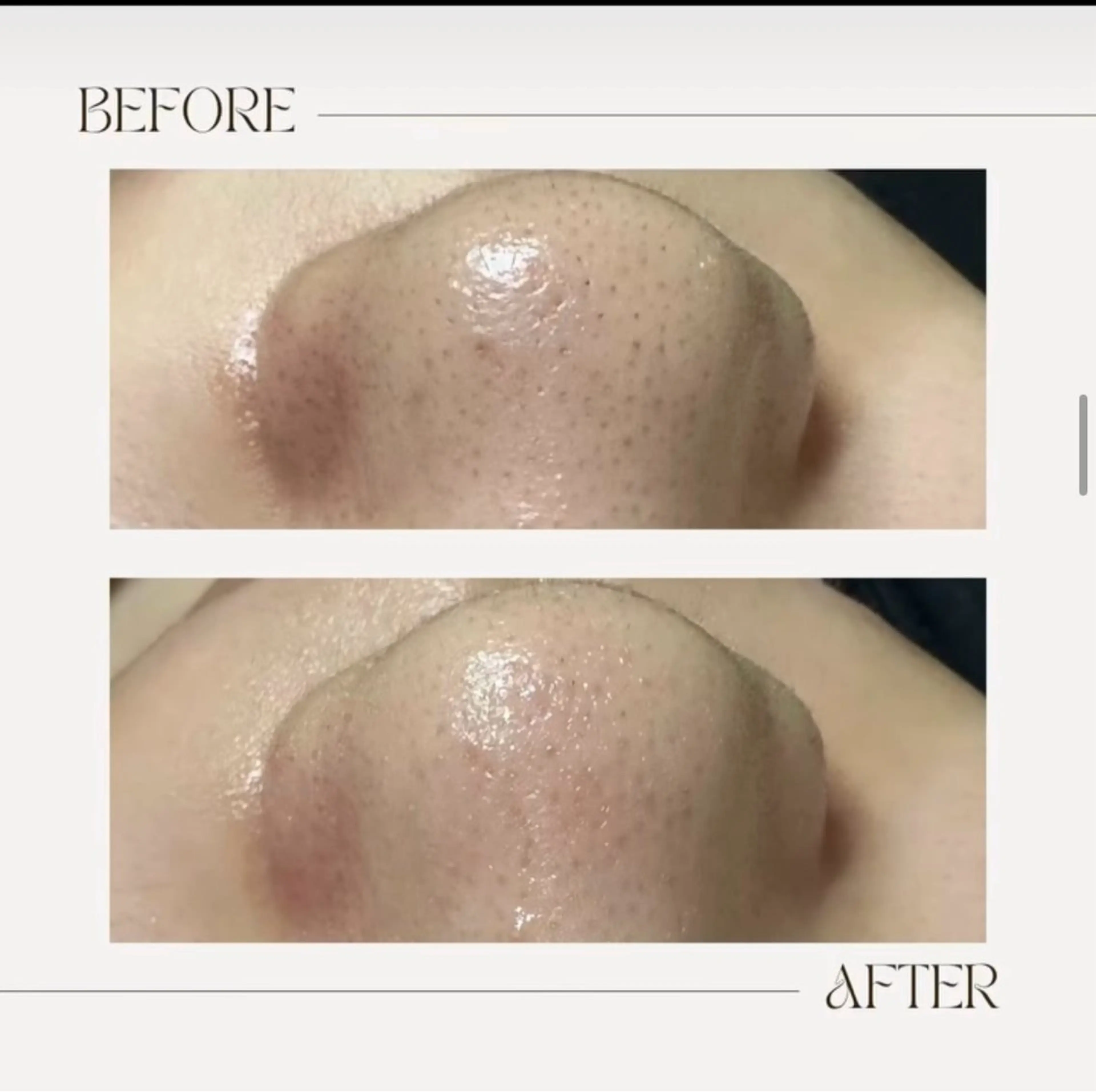 🦋肌改善 laule'a🦋のエステ・リラクイメージ