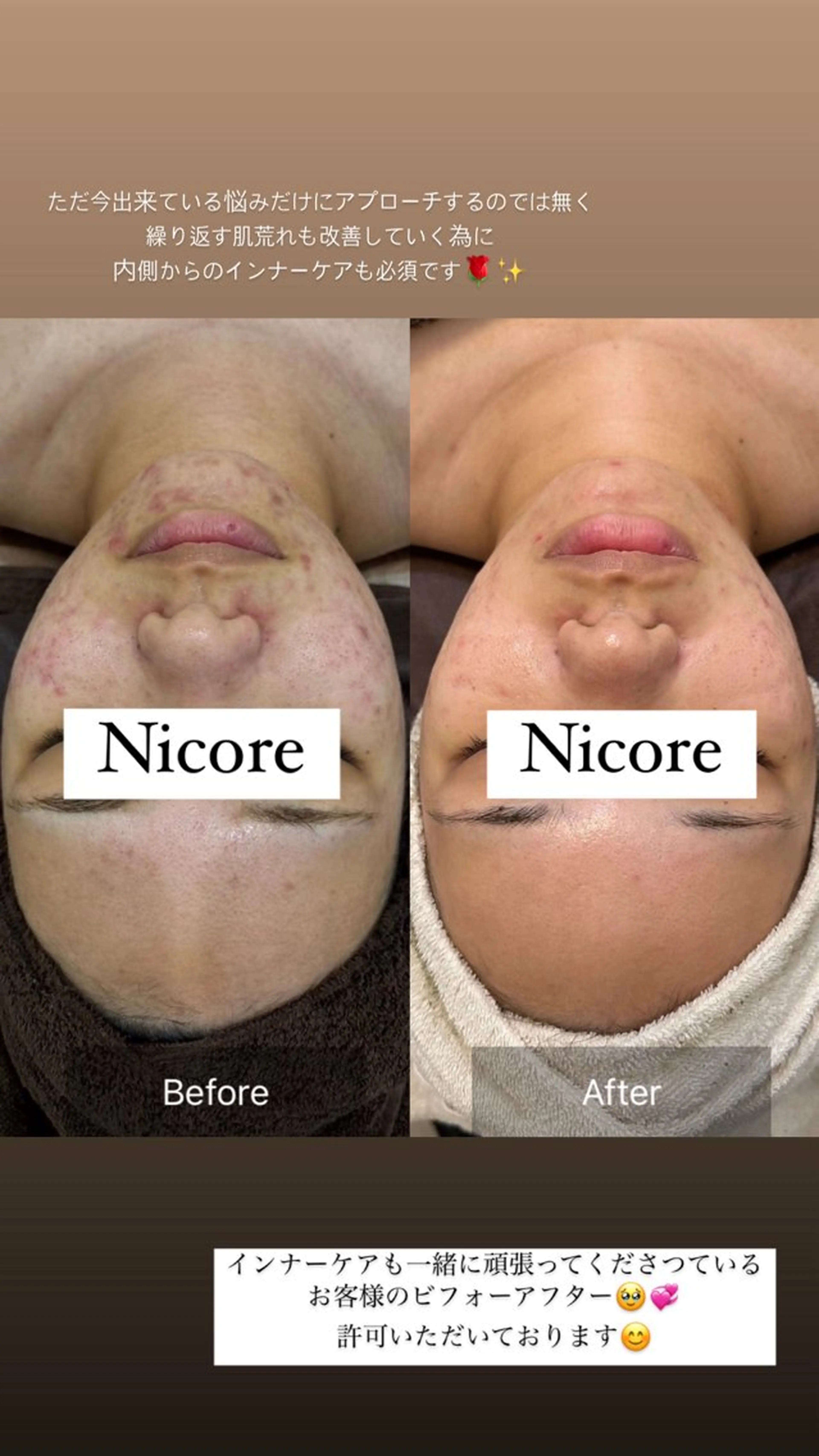 Nicore所属・肌質改善🌿まつ毛 chapiのその他イメージ