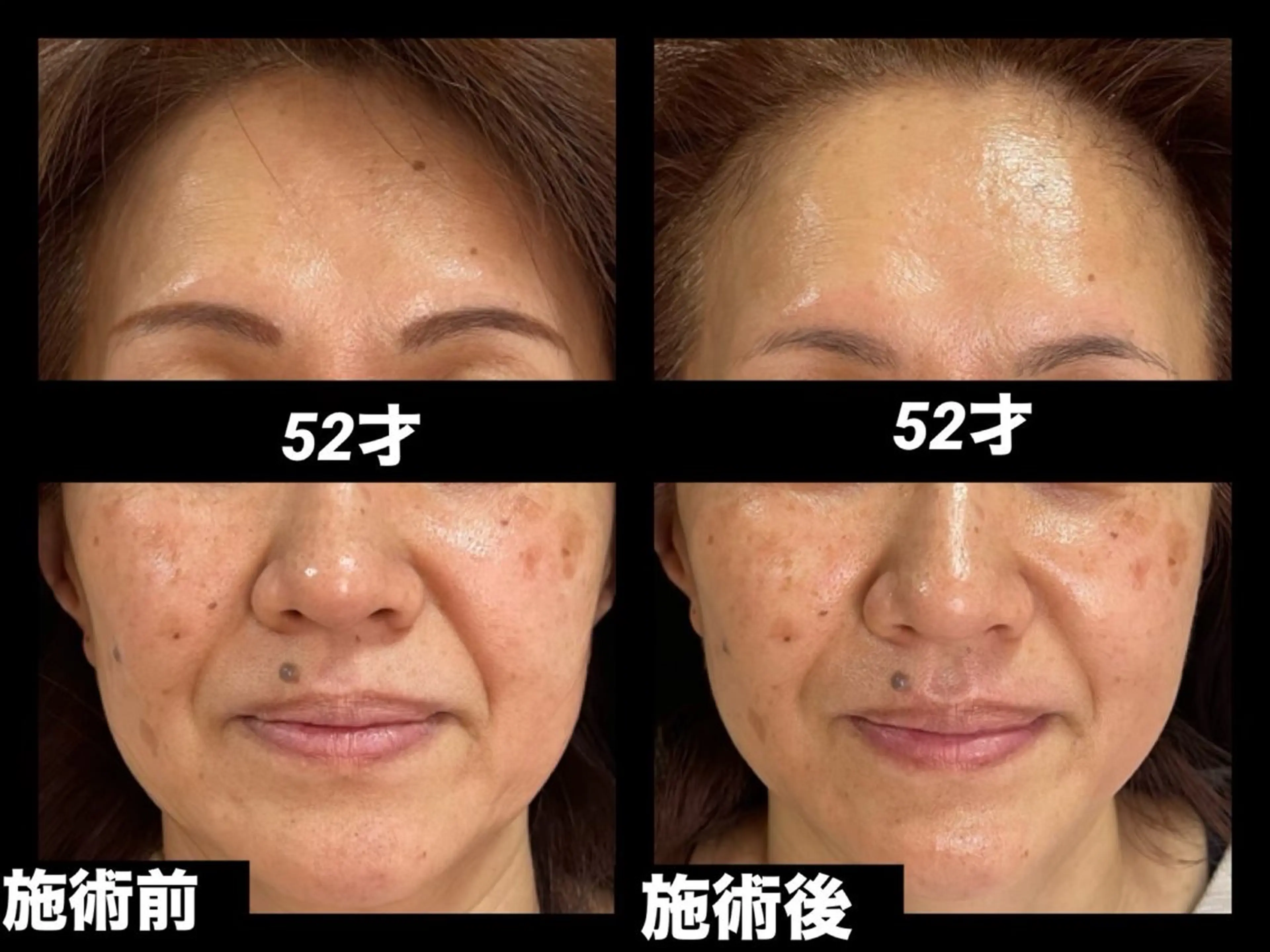 エステ リラク 夜エステサロン🌷Luana所属・夜サロン♡ Luana🦋.*˚のエステ・リラクイメージ