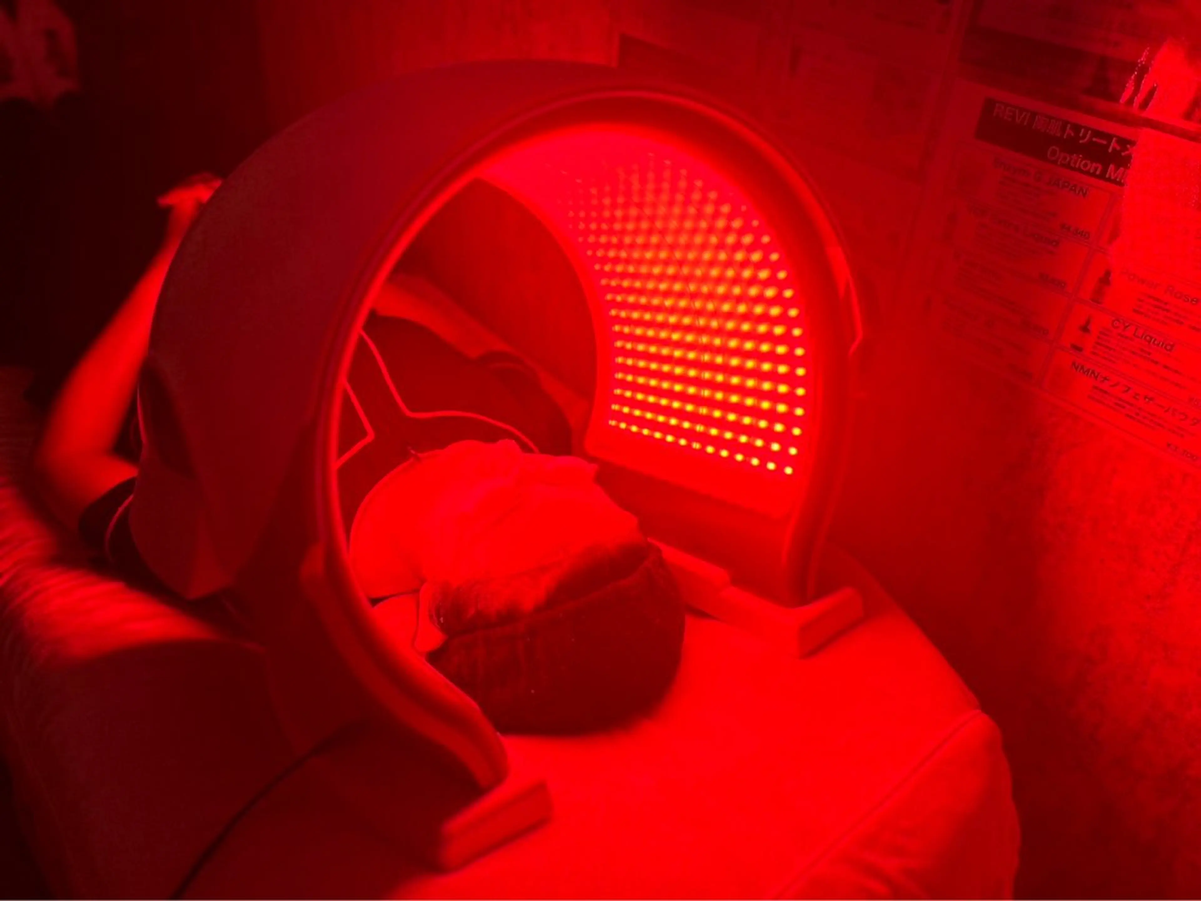 ホワイトタンニングの写真