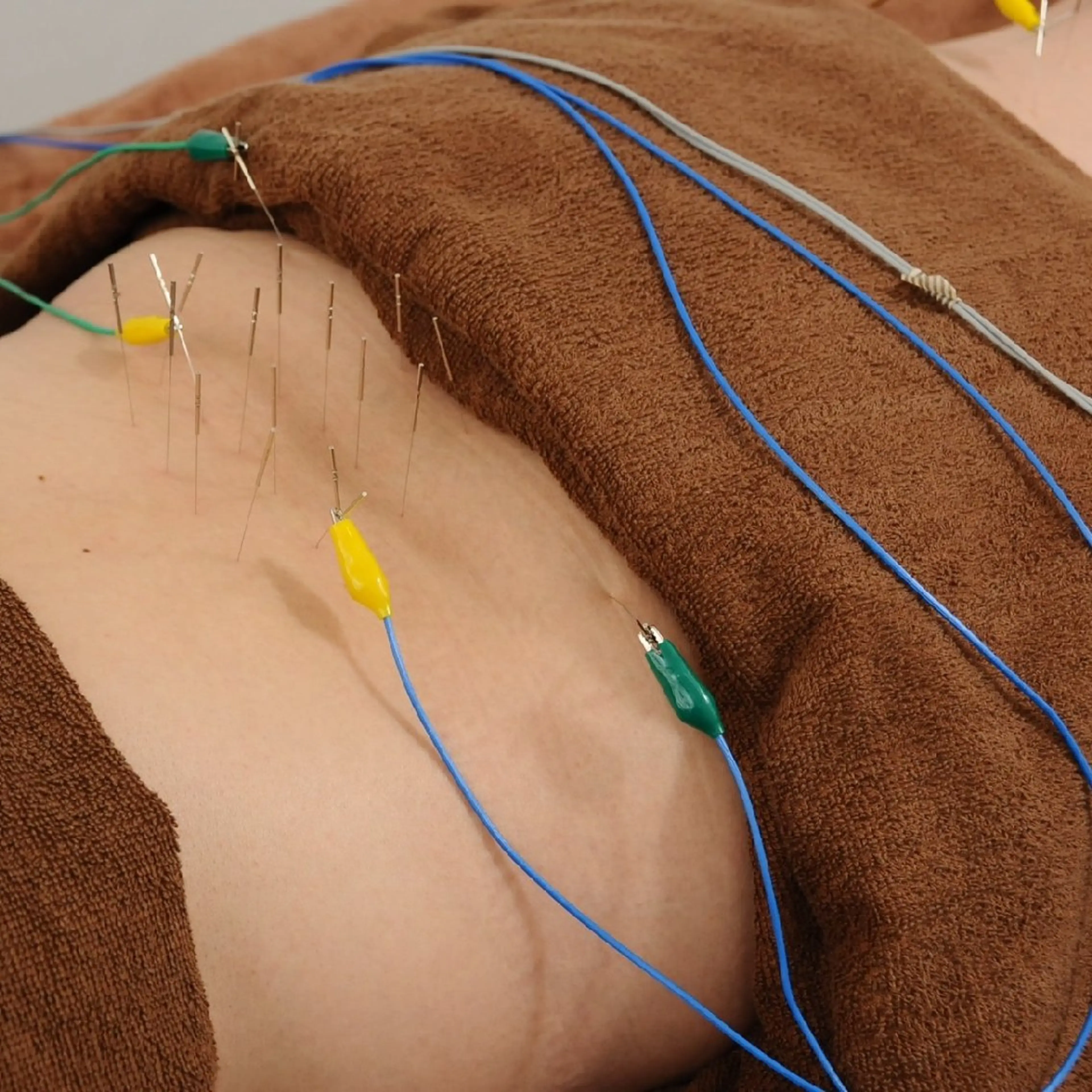 メンズ Spring鍼灸院所属・Spring鍼灸院 ✨首肩こり、腰痛に！のエステ・リラクイメージ