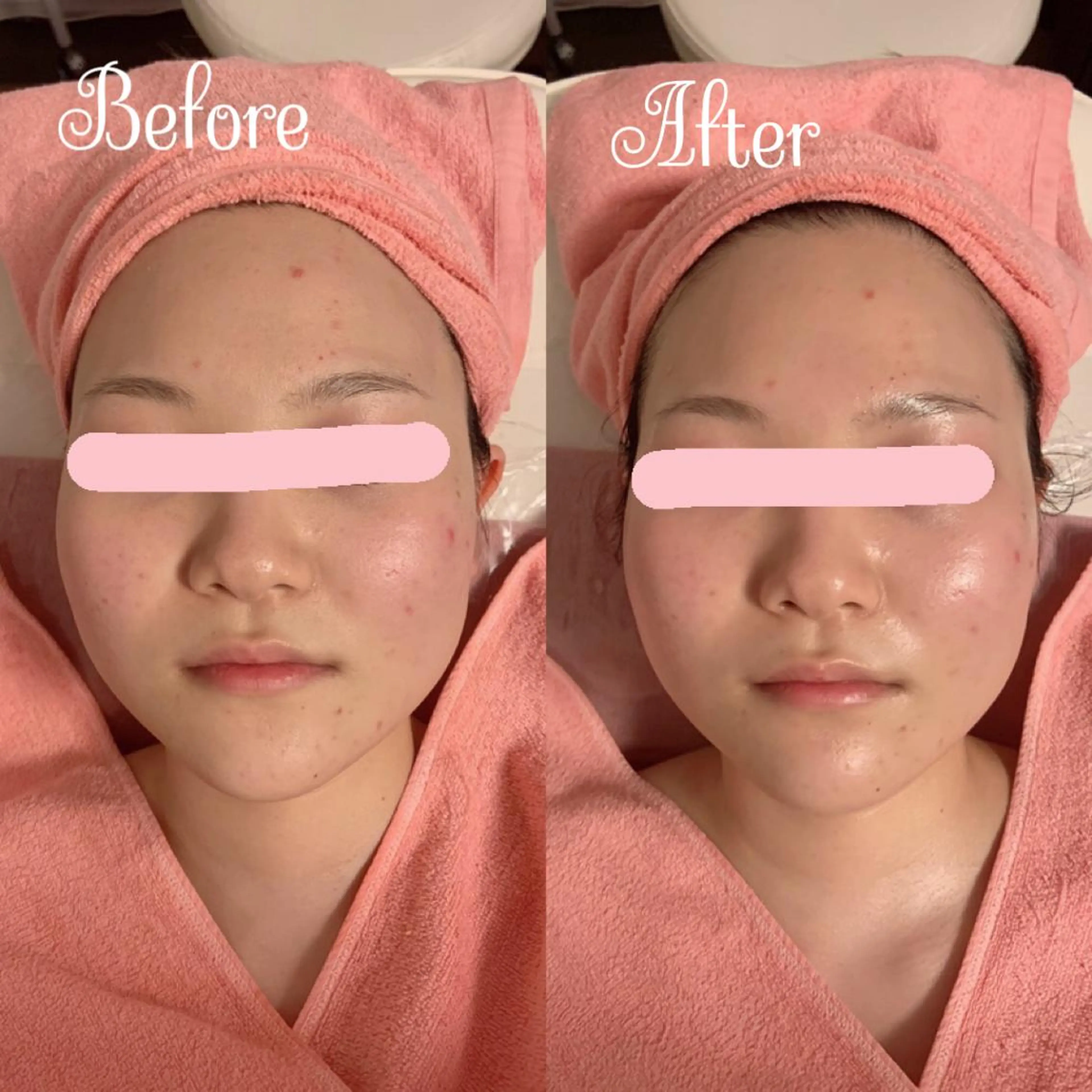 透明感の肌Lino malieのエステ・リラクイメージ