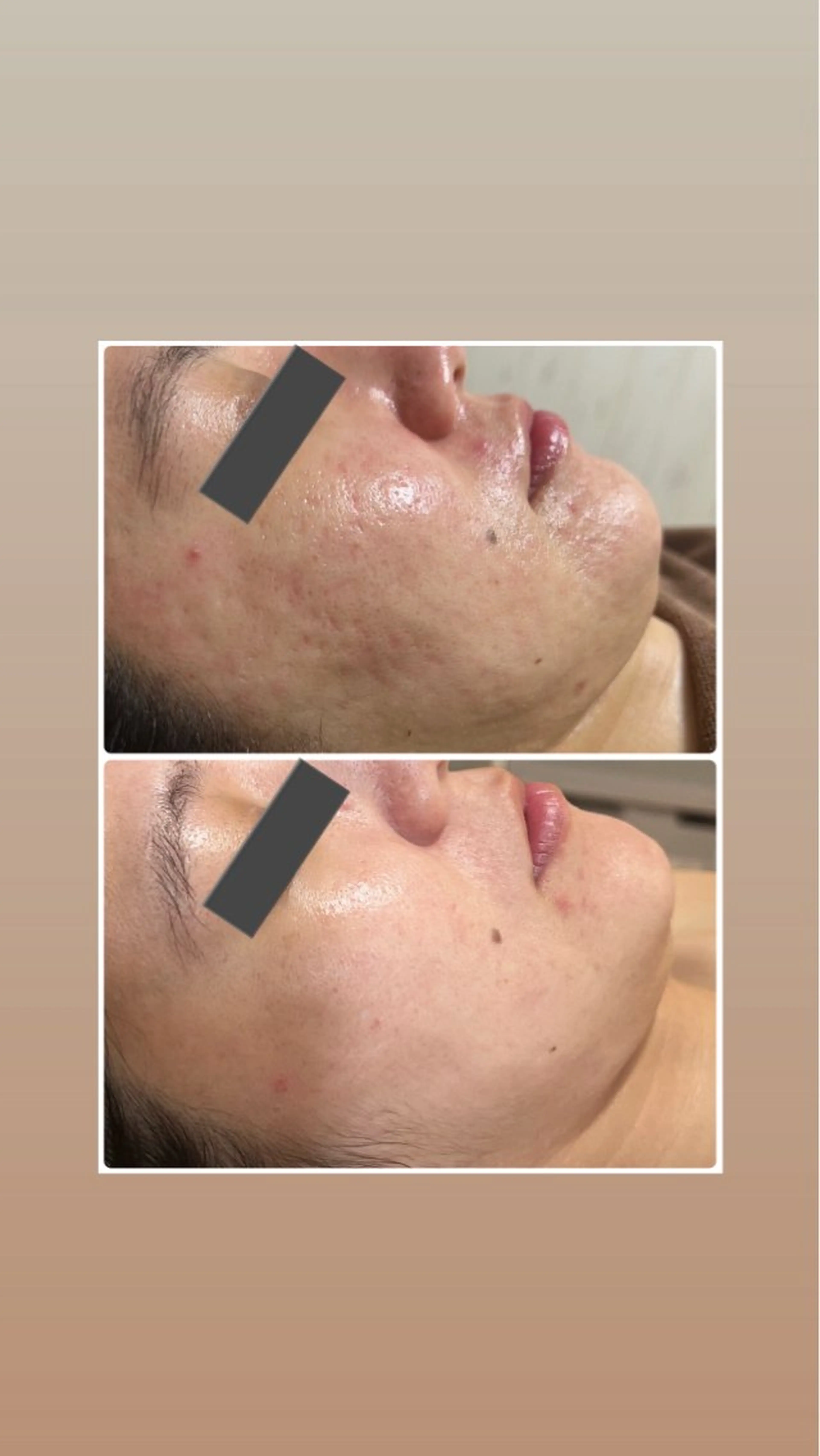 エステ ハーブ/小顔/リンパ /大阪狭山市のエステ・リラクイメージ