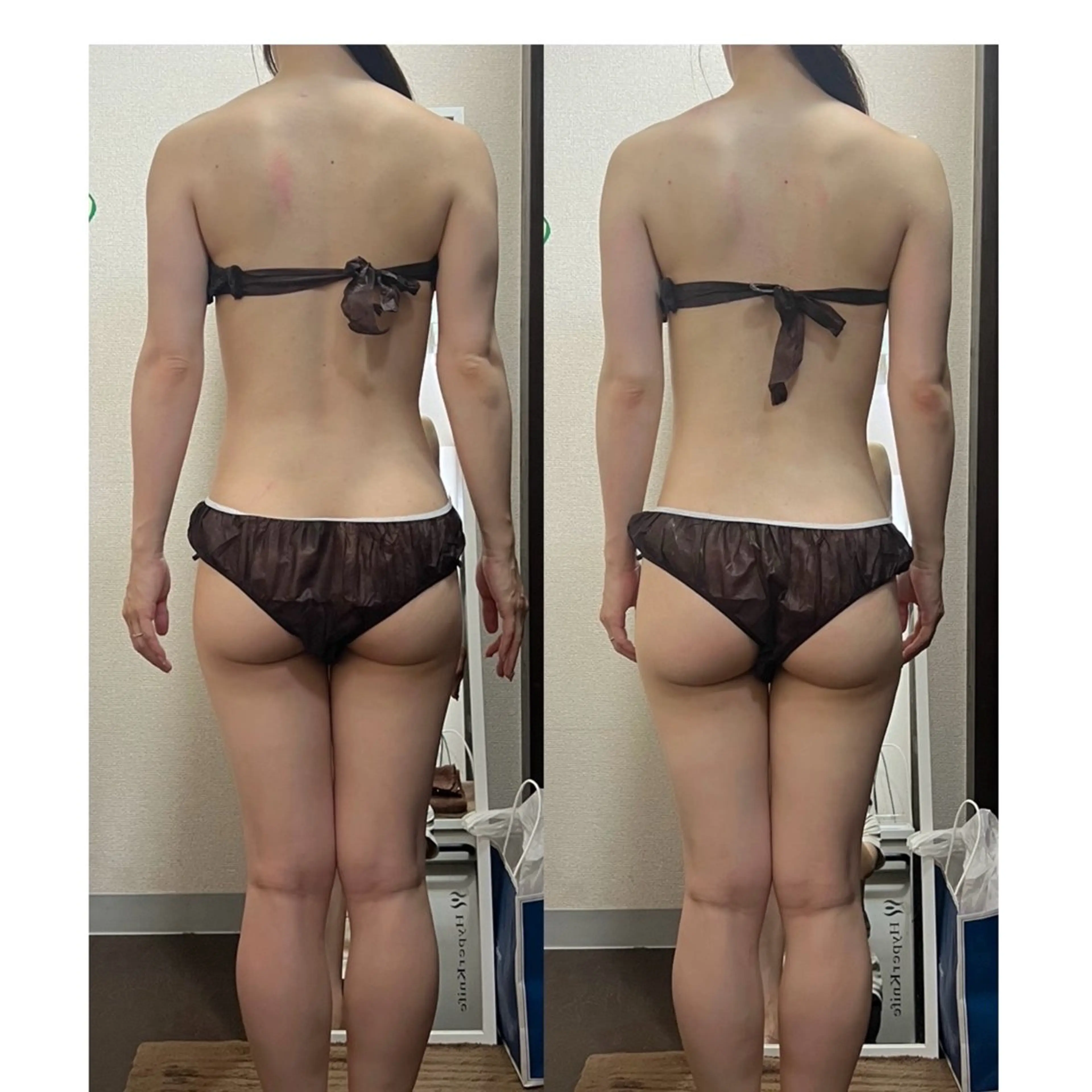 ハイパーナイフ専門店　Salon de COCO所属・Salon de COCOのエステ・リラクイメージ