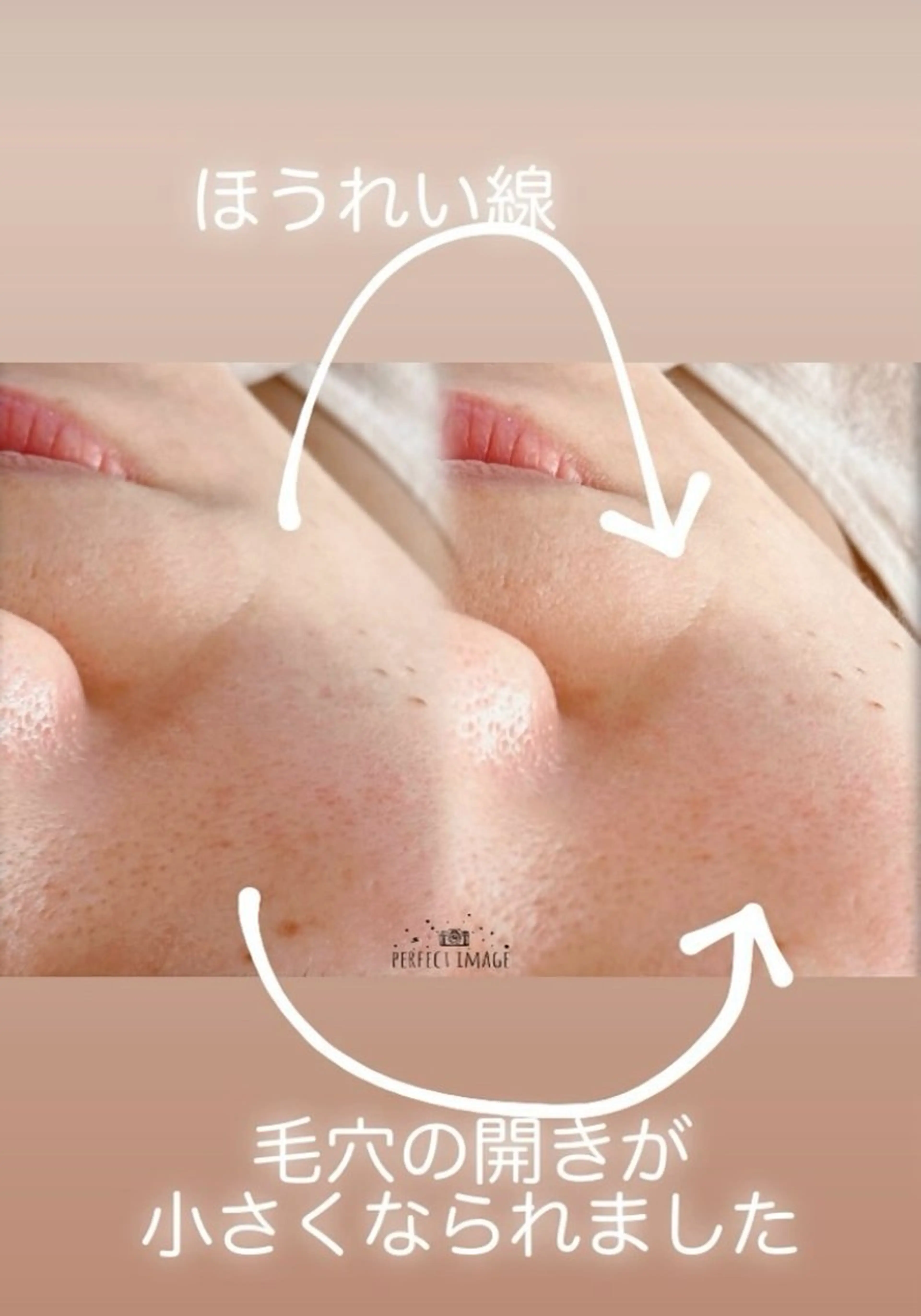 メナード熊本 嘉島のエステ・リラクイメージ