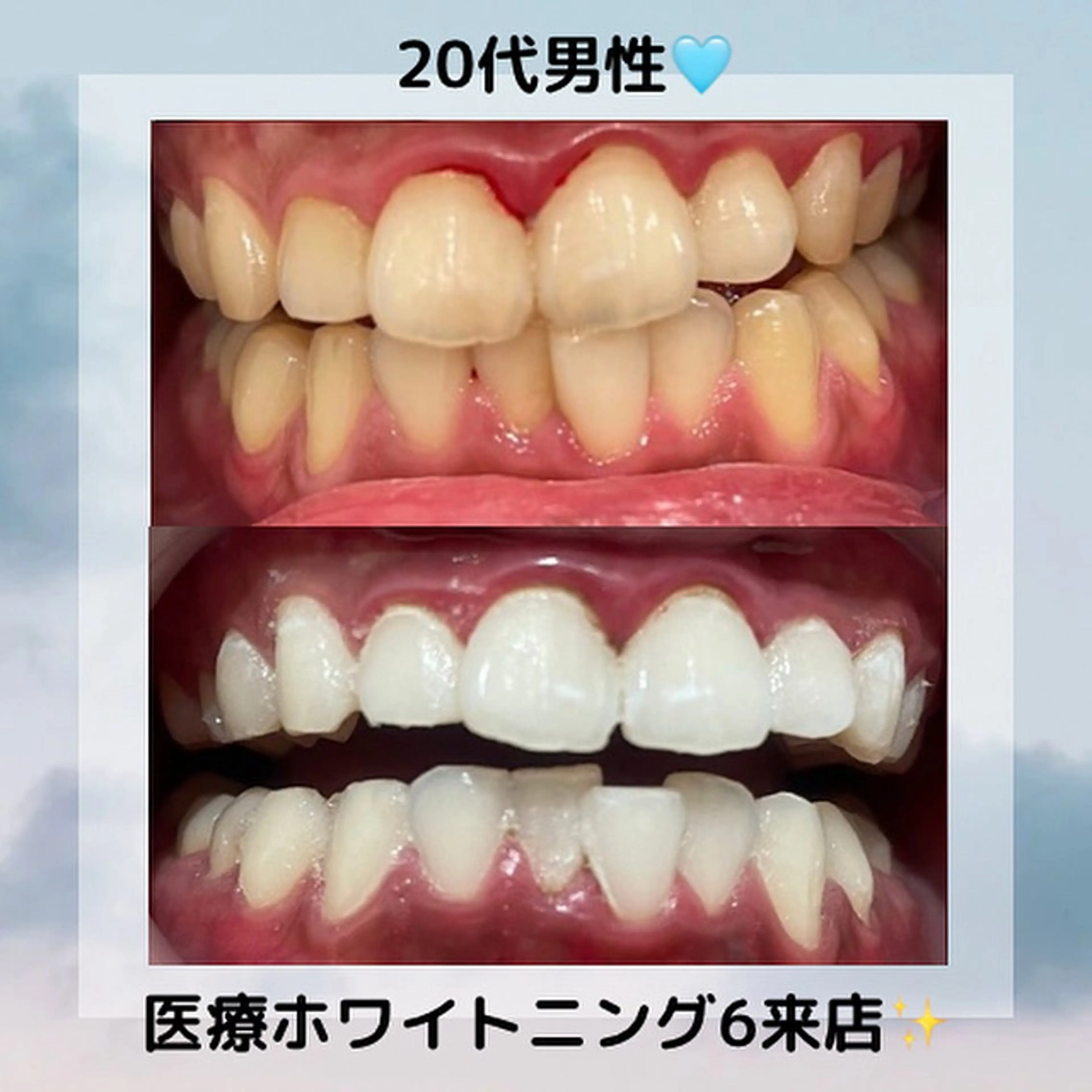 Kaula所属・Kaula ホワイトニング耳ツボのエステ・リラクイメージ