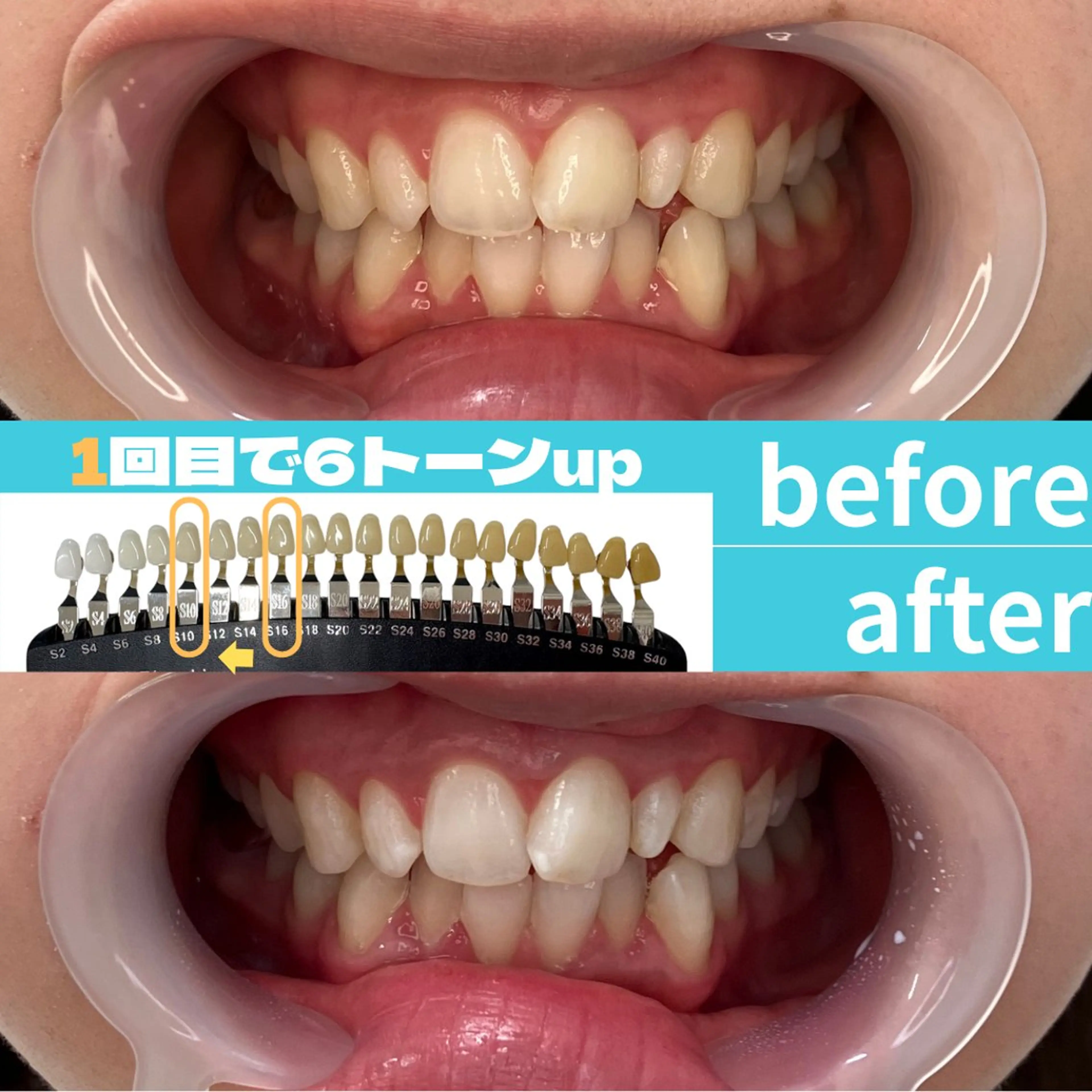 エステ s rikoのエステ・リラクイメージ