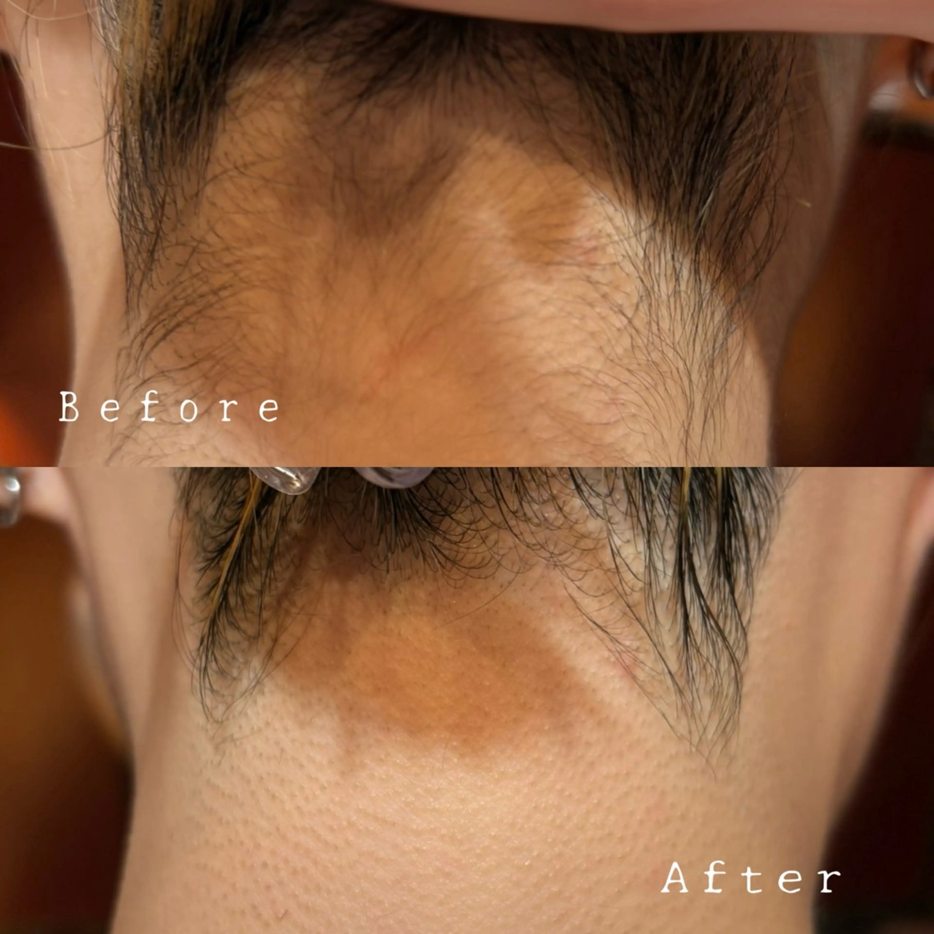 脱毛 あかいけ .のエステ・リラクイメージ