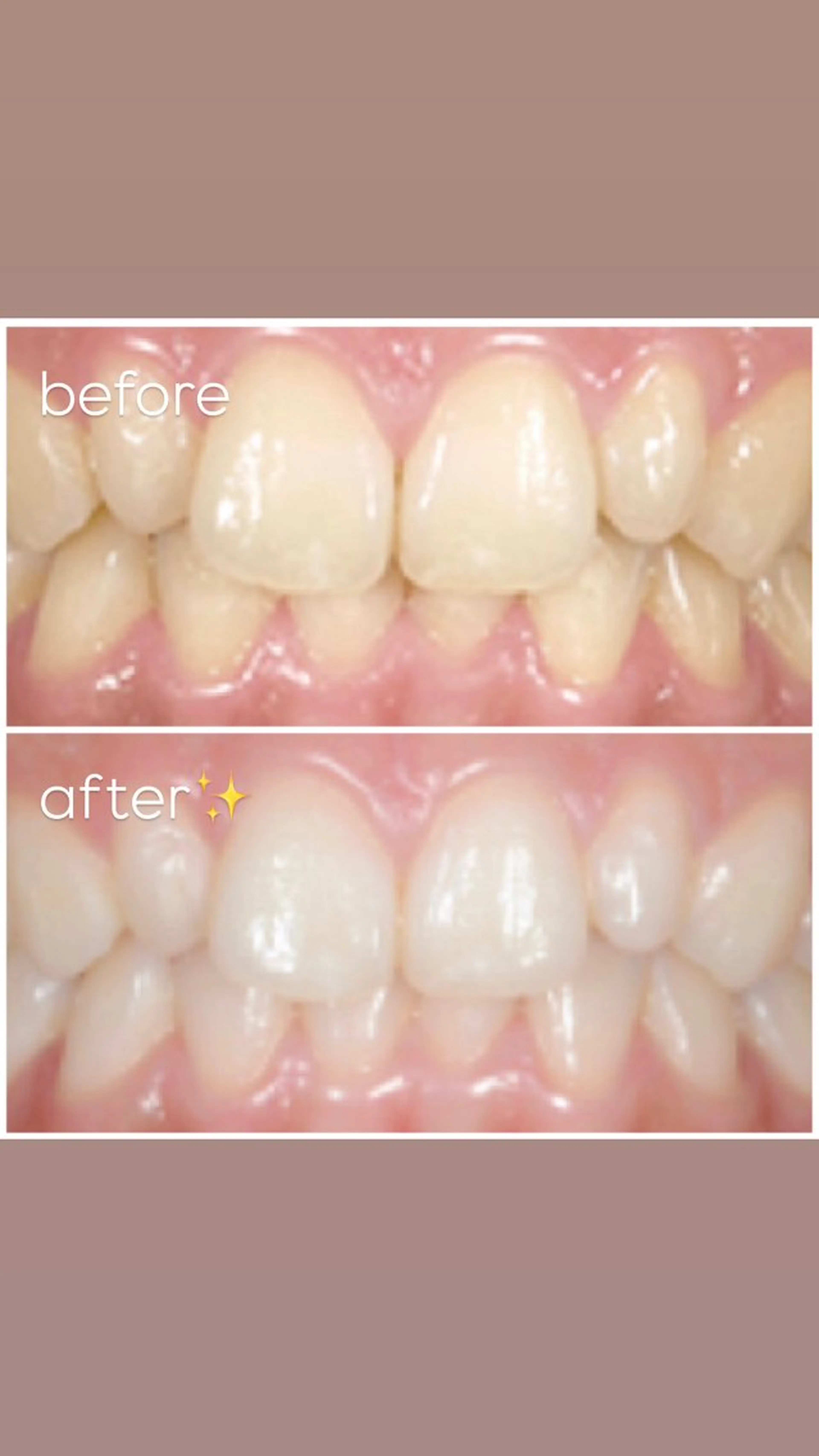 エクシア津駅前店所属・セルフホワイトニング エクシア津駅前店のその他イメージ