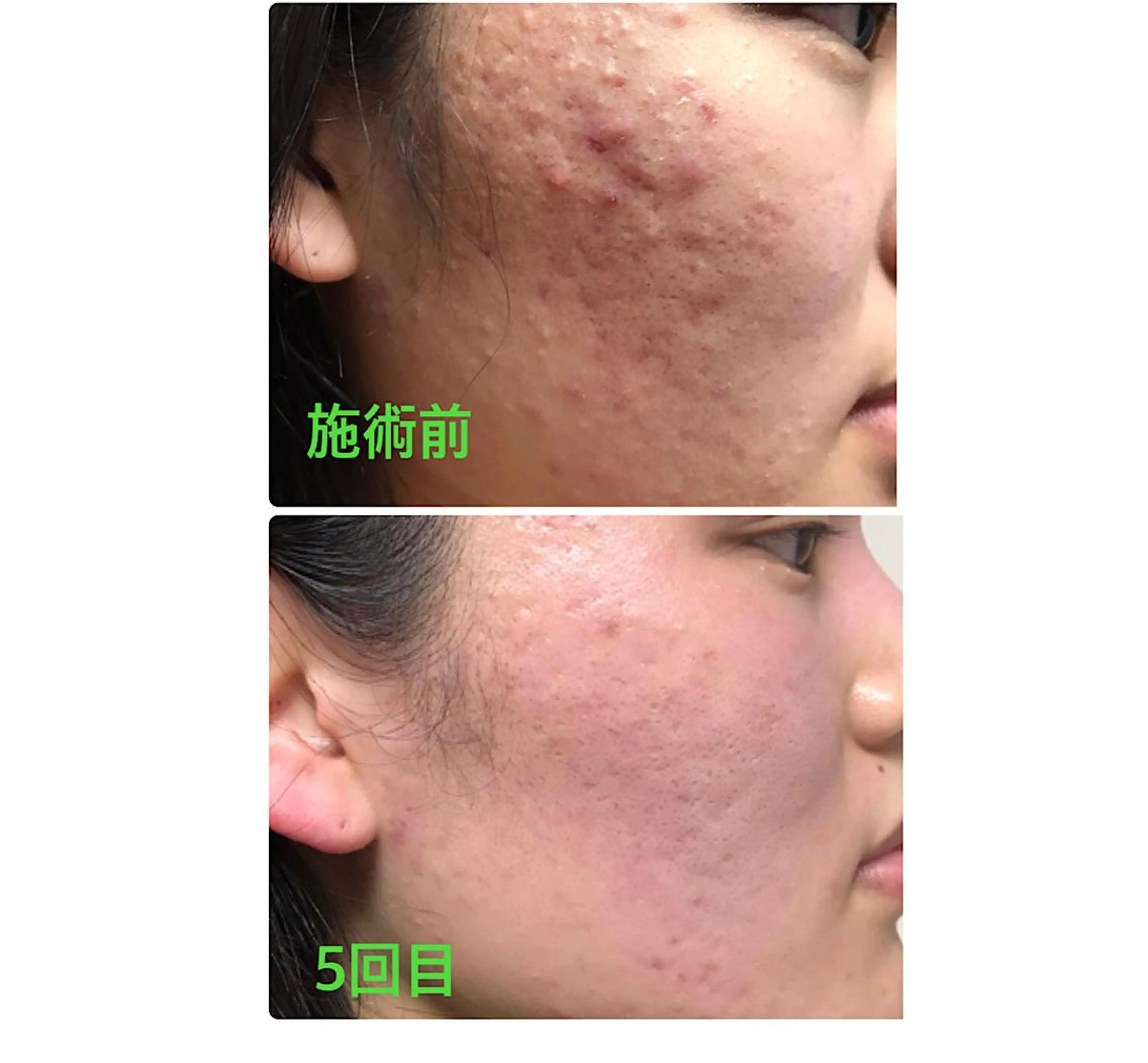 横浜ビューティーファクトリーHANA元町店所属・エステ＆アロマ HANAのエステ・リラクイメージ