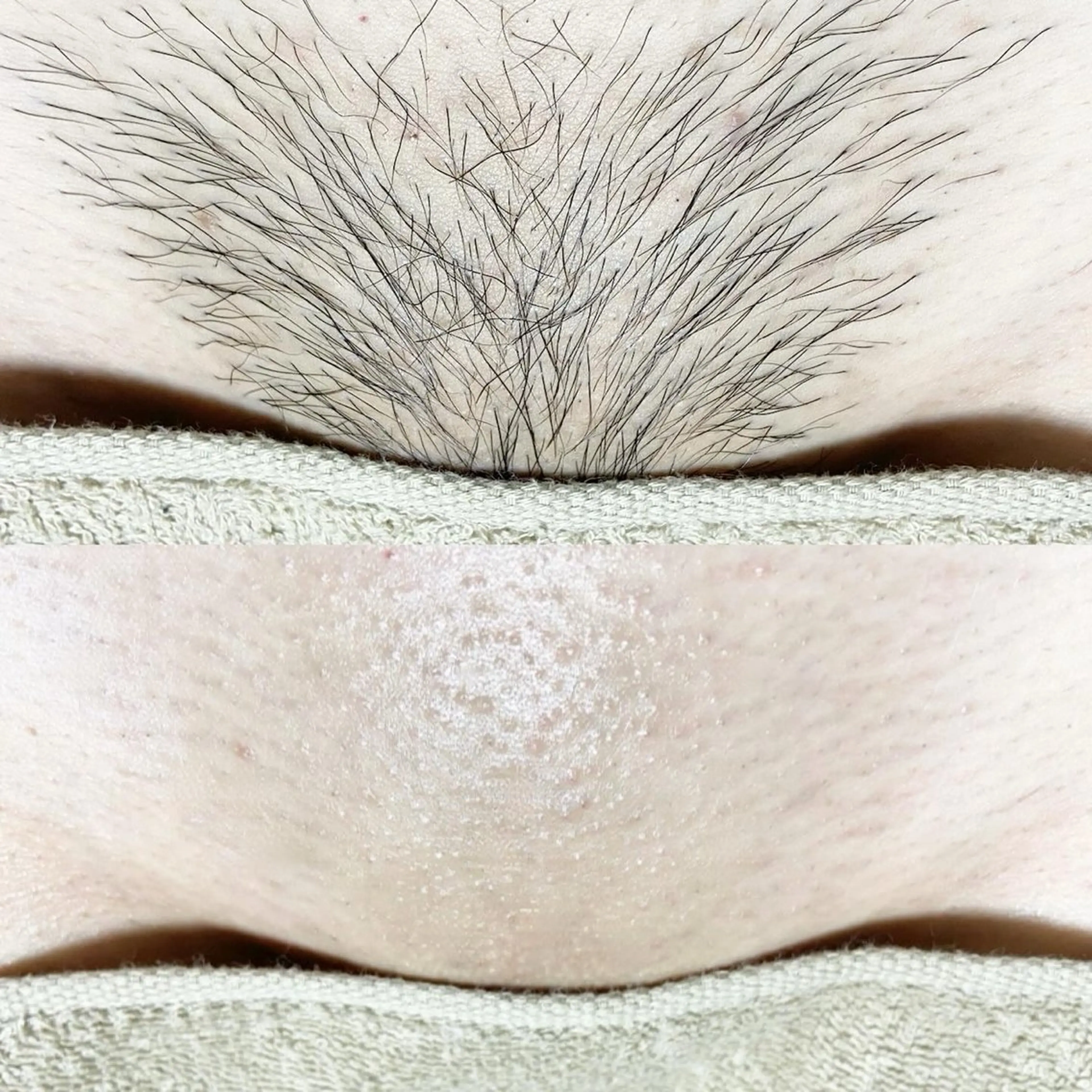 脱毛 &me ayakaのエステ・リラクイメージ