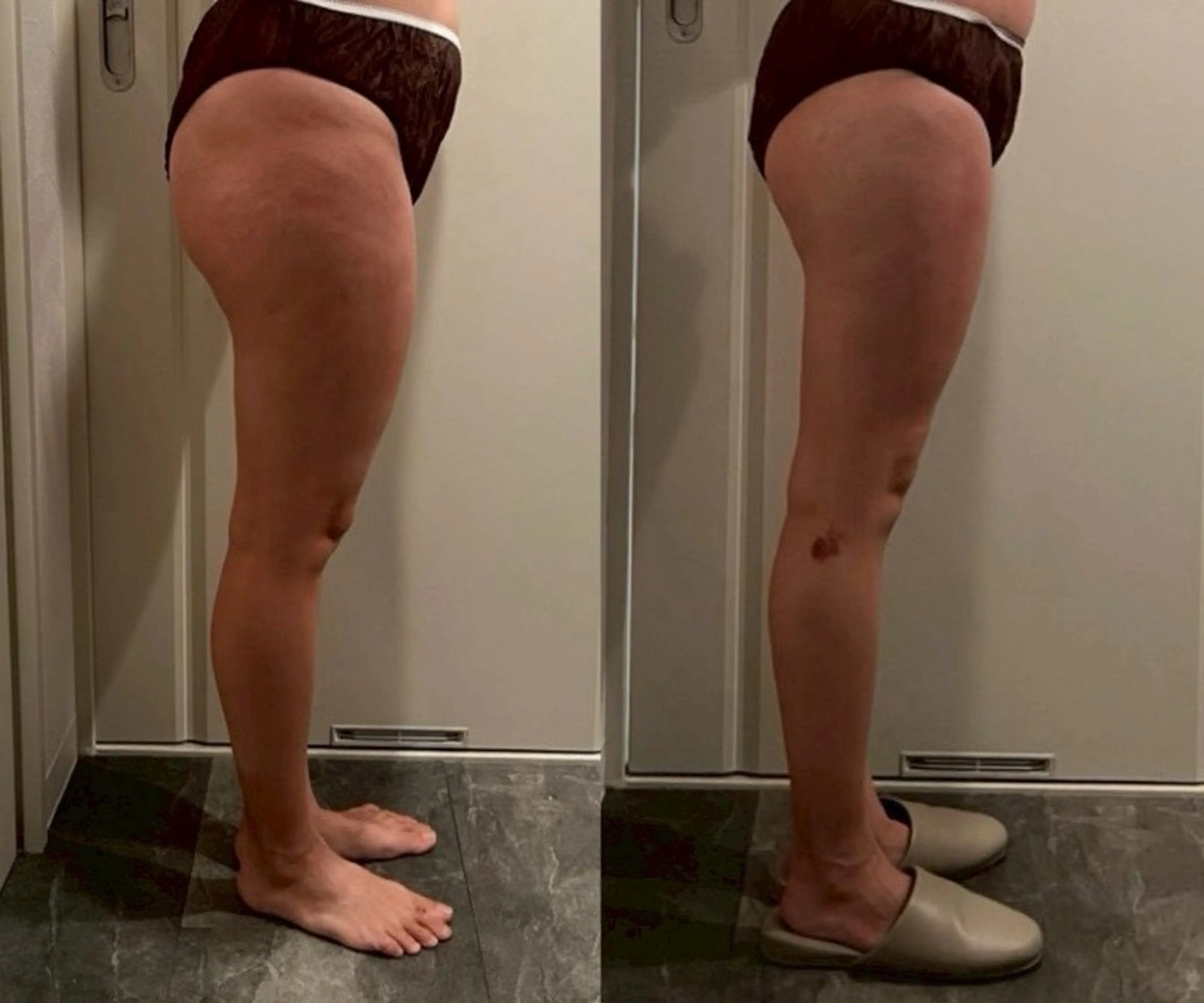 痩身/フェイシャル 💓KOUMA💓のエステ・リラクイメージ