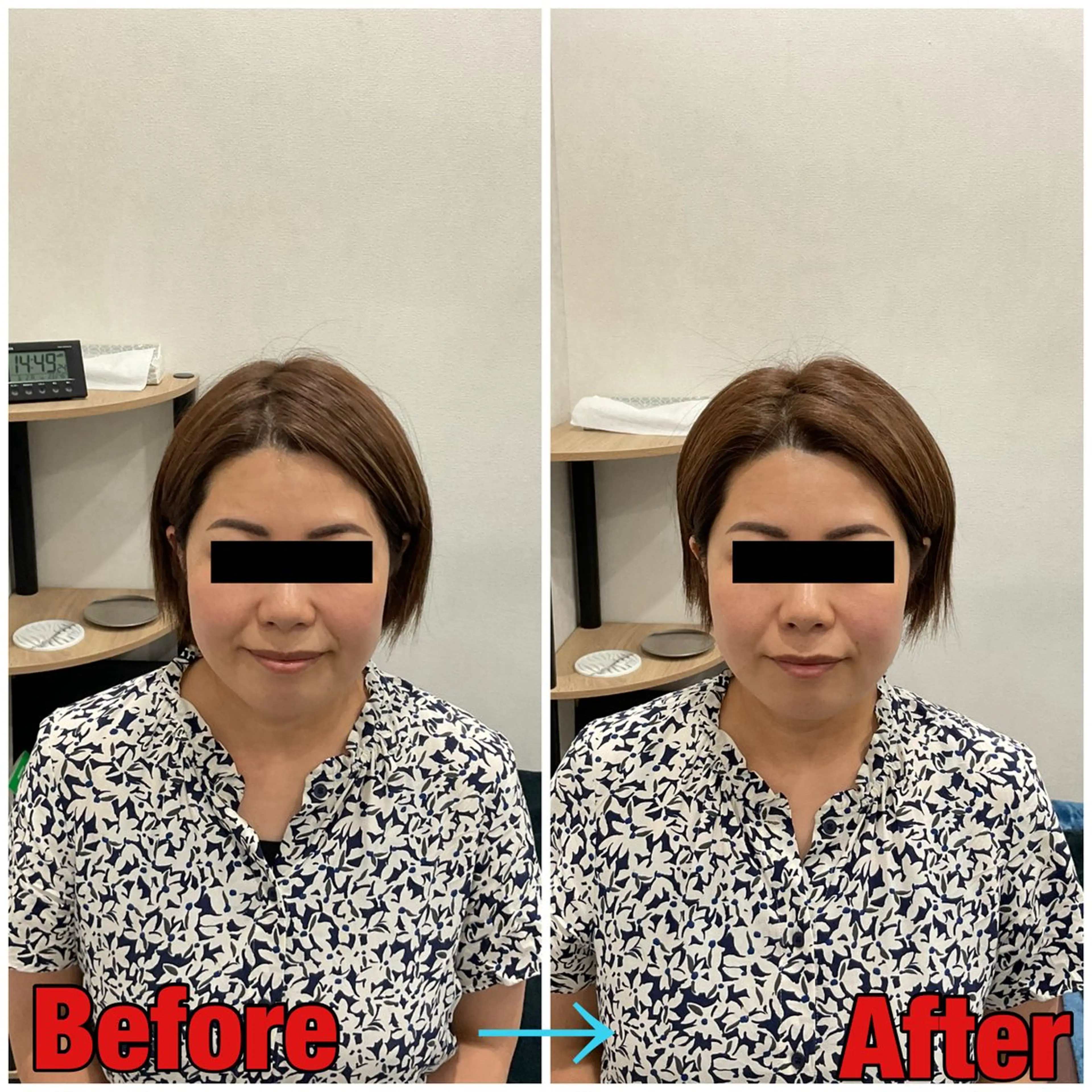 エステ リラク 小顔矯正・美容鍼 FLOW鍼灸整体院のエステ・リラクイメージ