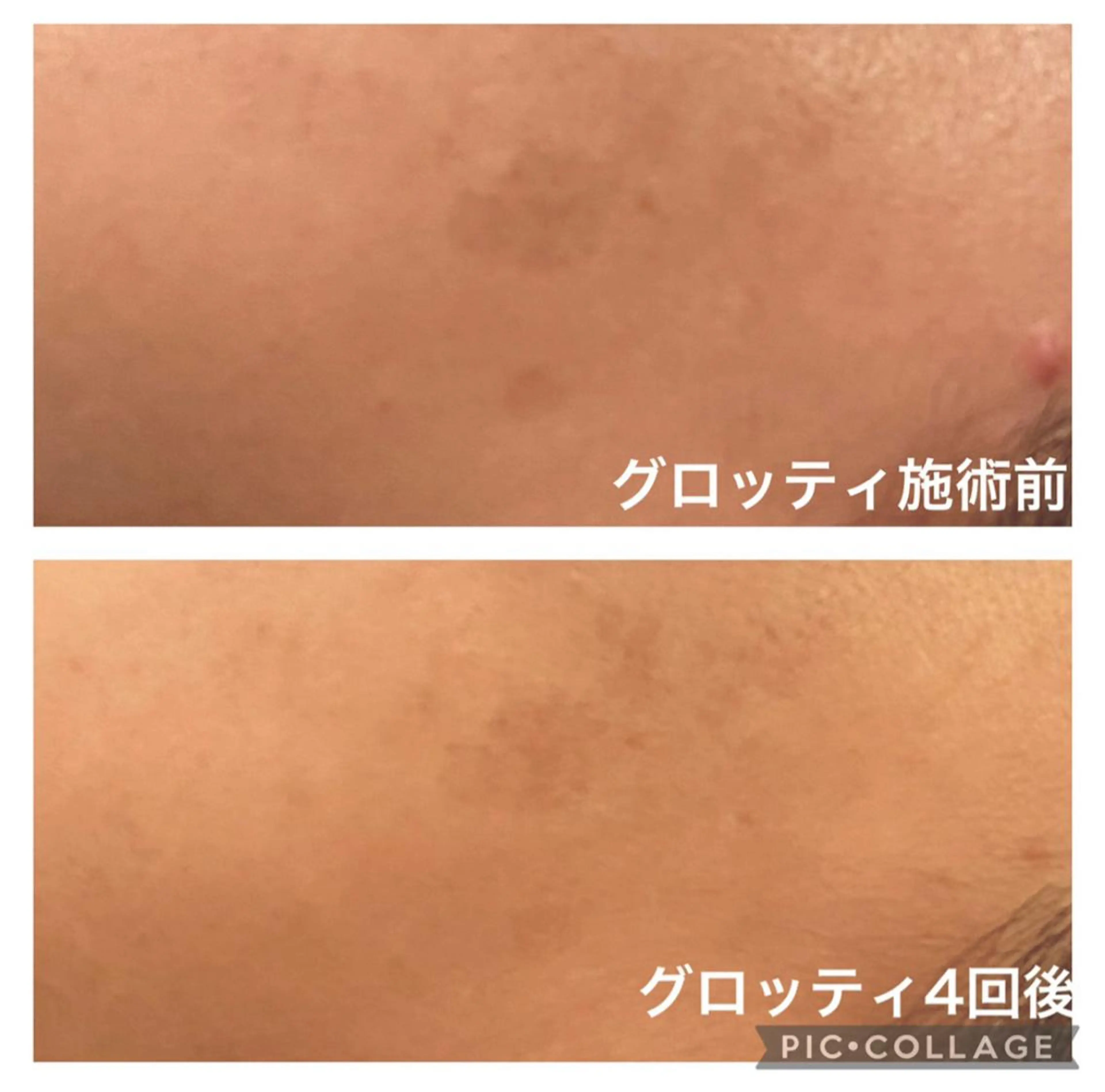 ルラーシュ　店長 日置美幸のエステ・リラクイメージ