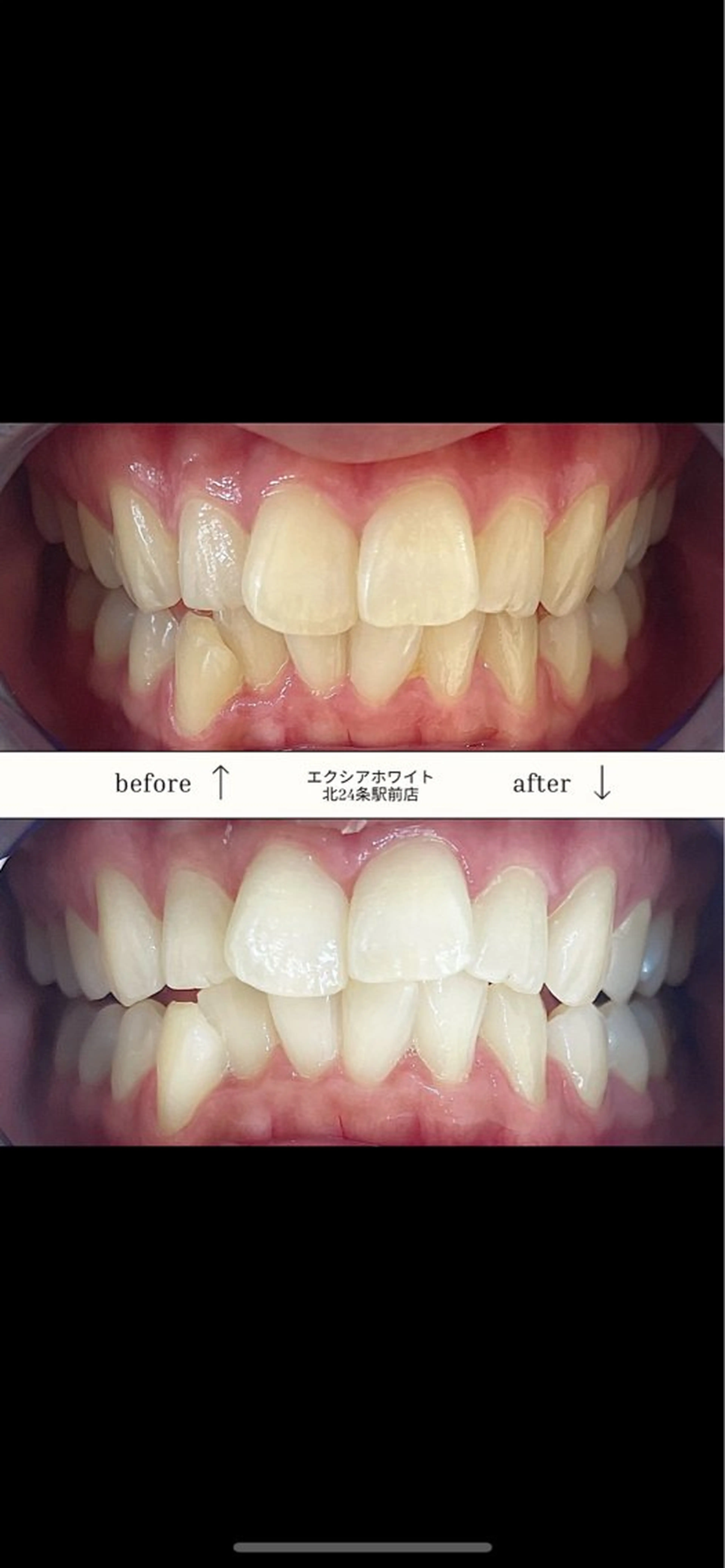 その他 エクシアホワイトニング平岸店所属・𝒀𝑼𝑰 店長⋆𝜗𝜚のその他イメージ