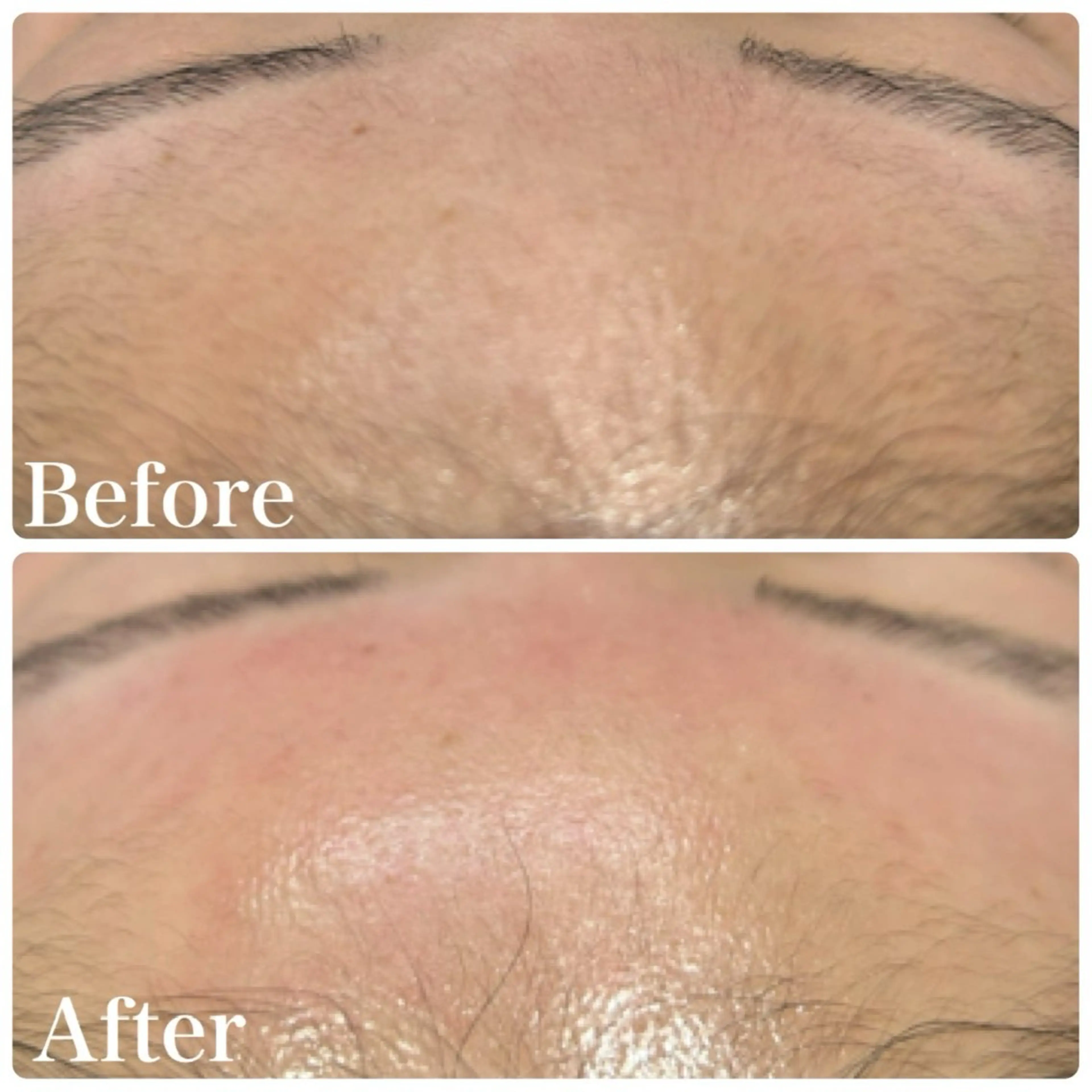 エステ ハーブ&艶肌ワックス re:proのエステ・リラクイメージ