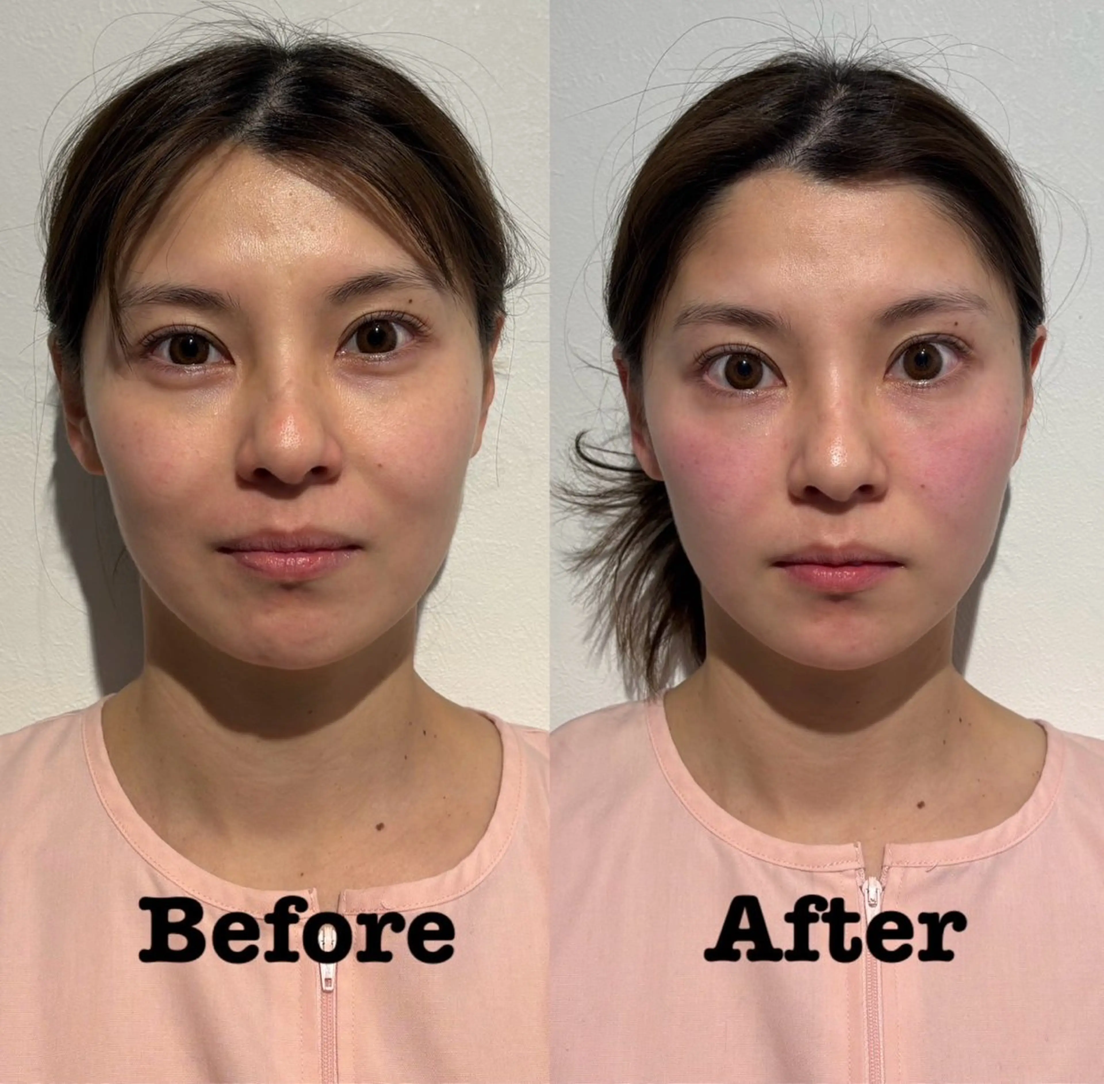 エステ リラク 美容鍼灸サロン mahoroba院長のエステ・リラクイメージ