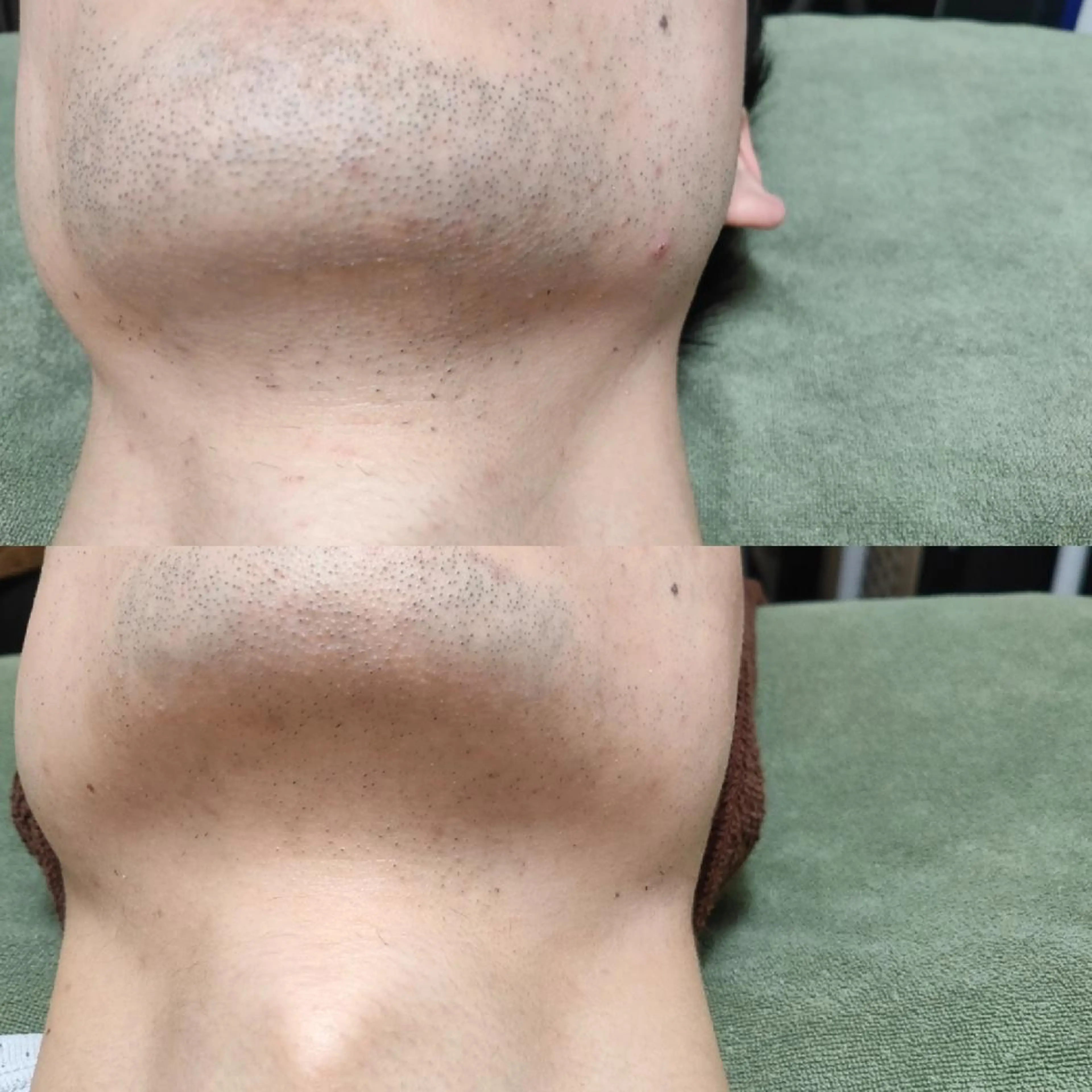 メンズ 武 藤のエステ・リラクイメージ