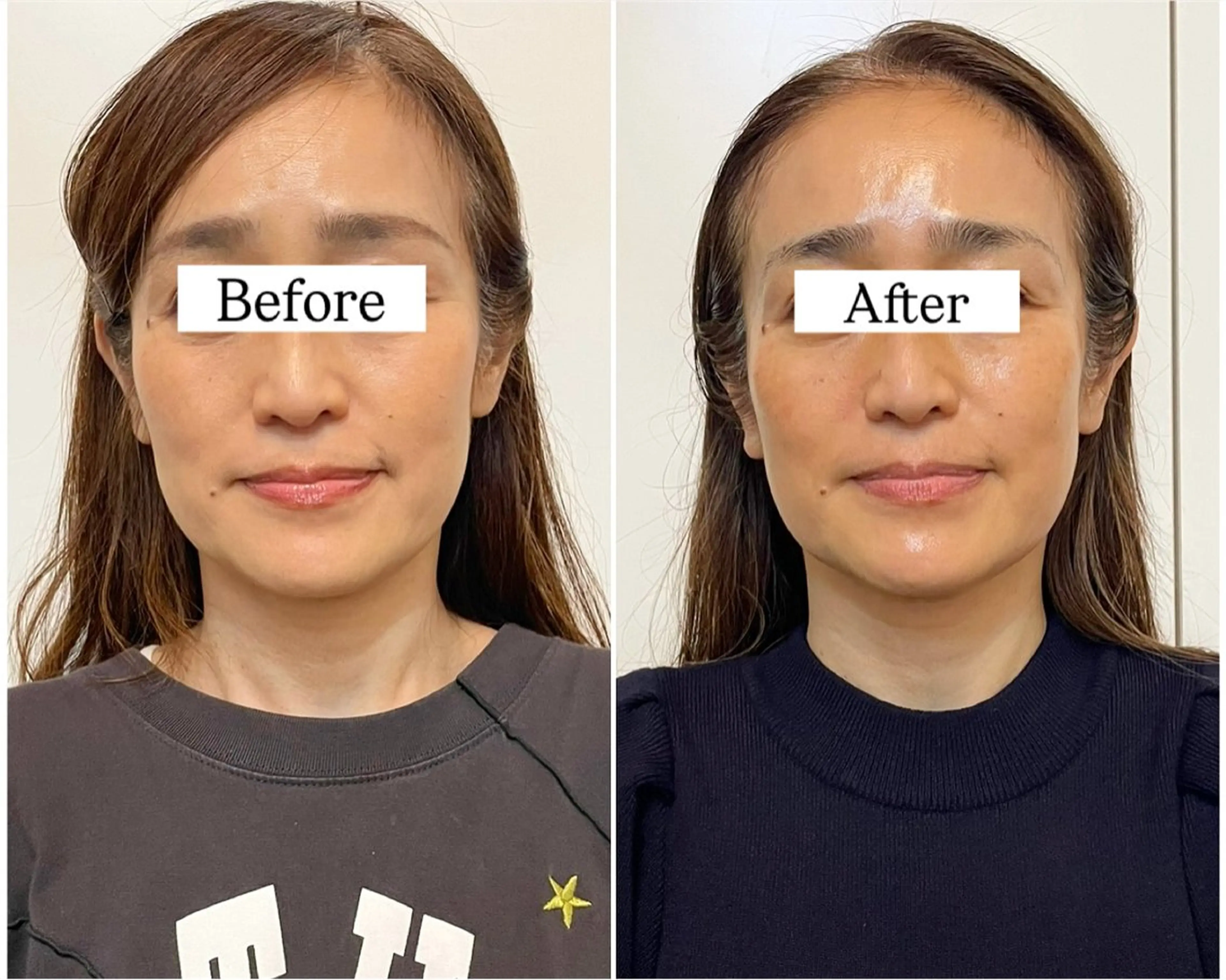 エステ リラク Private SalonOboraのエステ・リラクイメージ