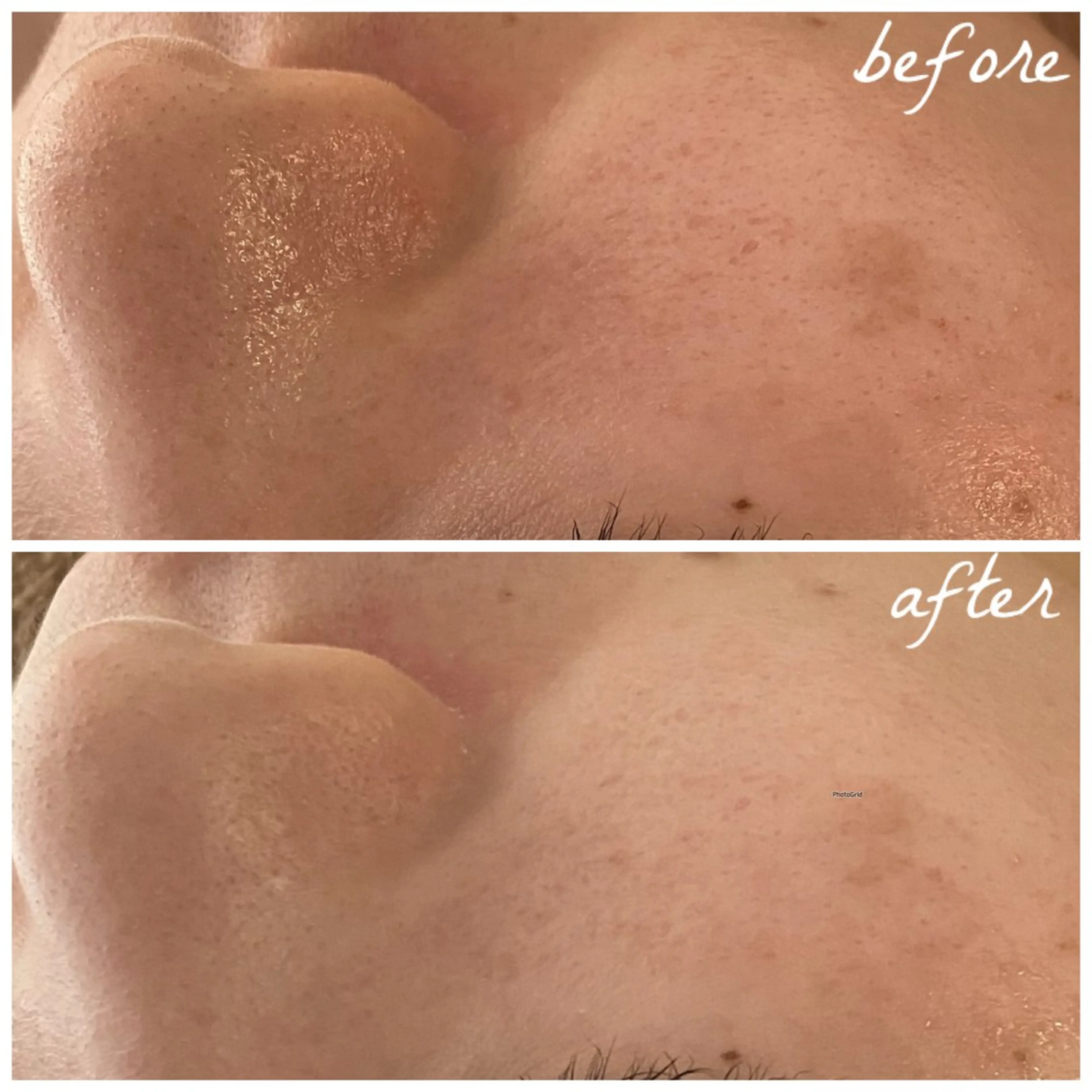 メンズ エステ メナード岐阜茜部 杉浦のエステ・リラクイメージ