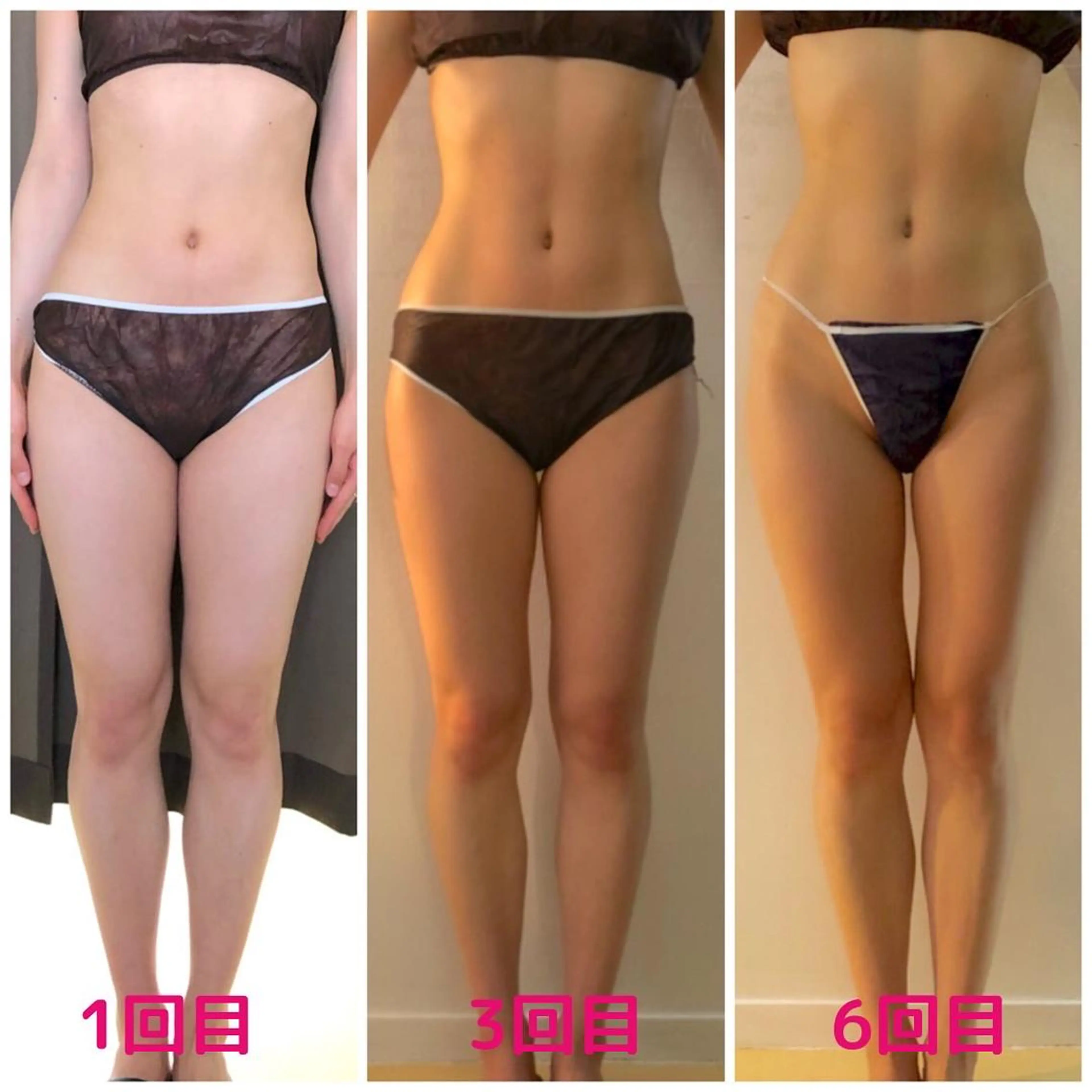 小顔・痩身専門店 Sunao所属・小顔.足痩せ整体 痩身天六Sunaoのその他イメージ