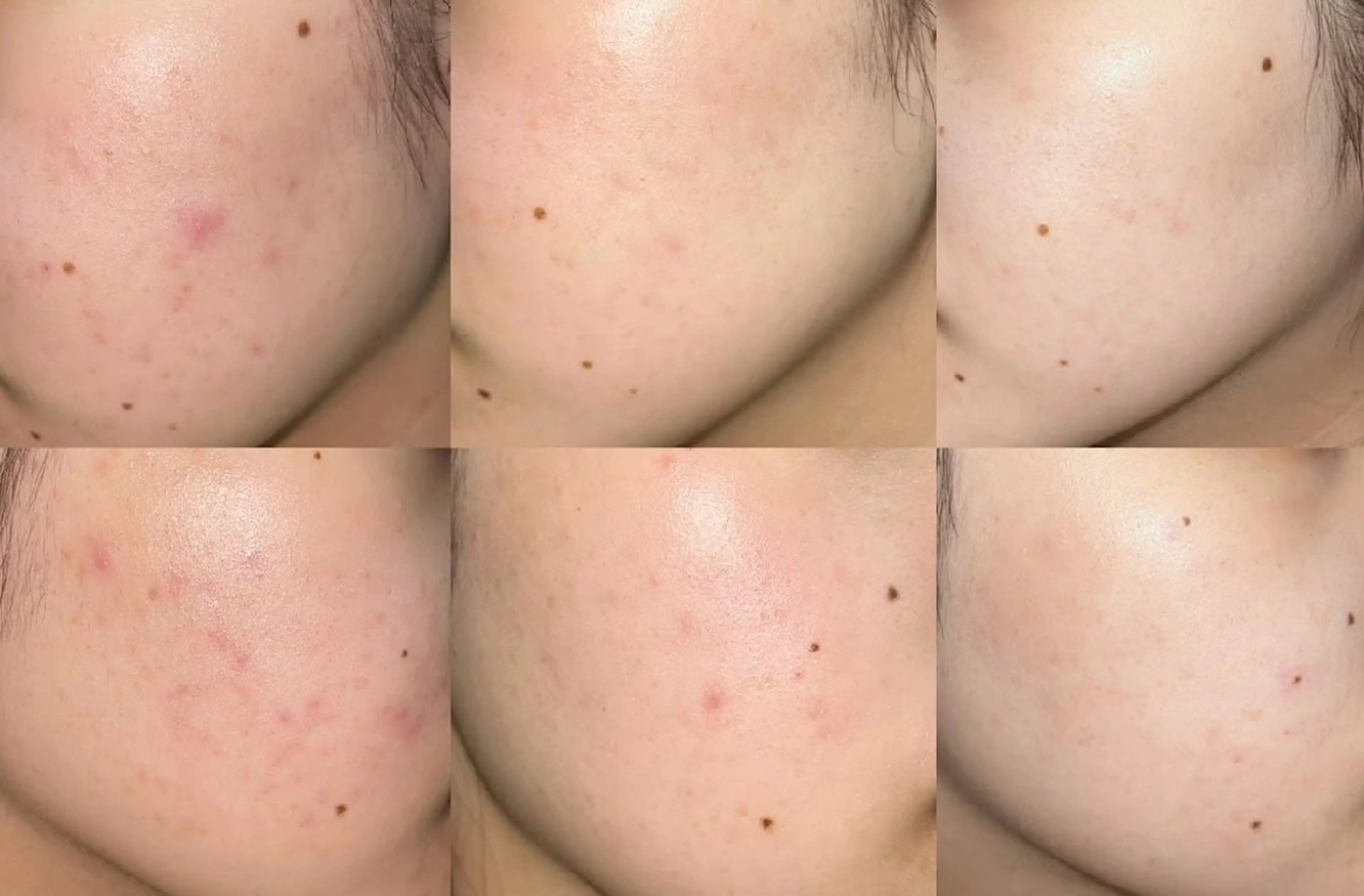 韓国肌管理Belle堀江所属・韓国肌管理 Belle堀江のエステ・リラクイメージ