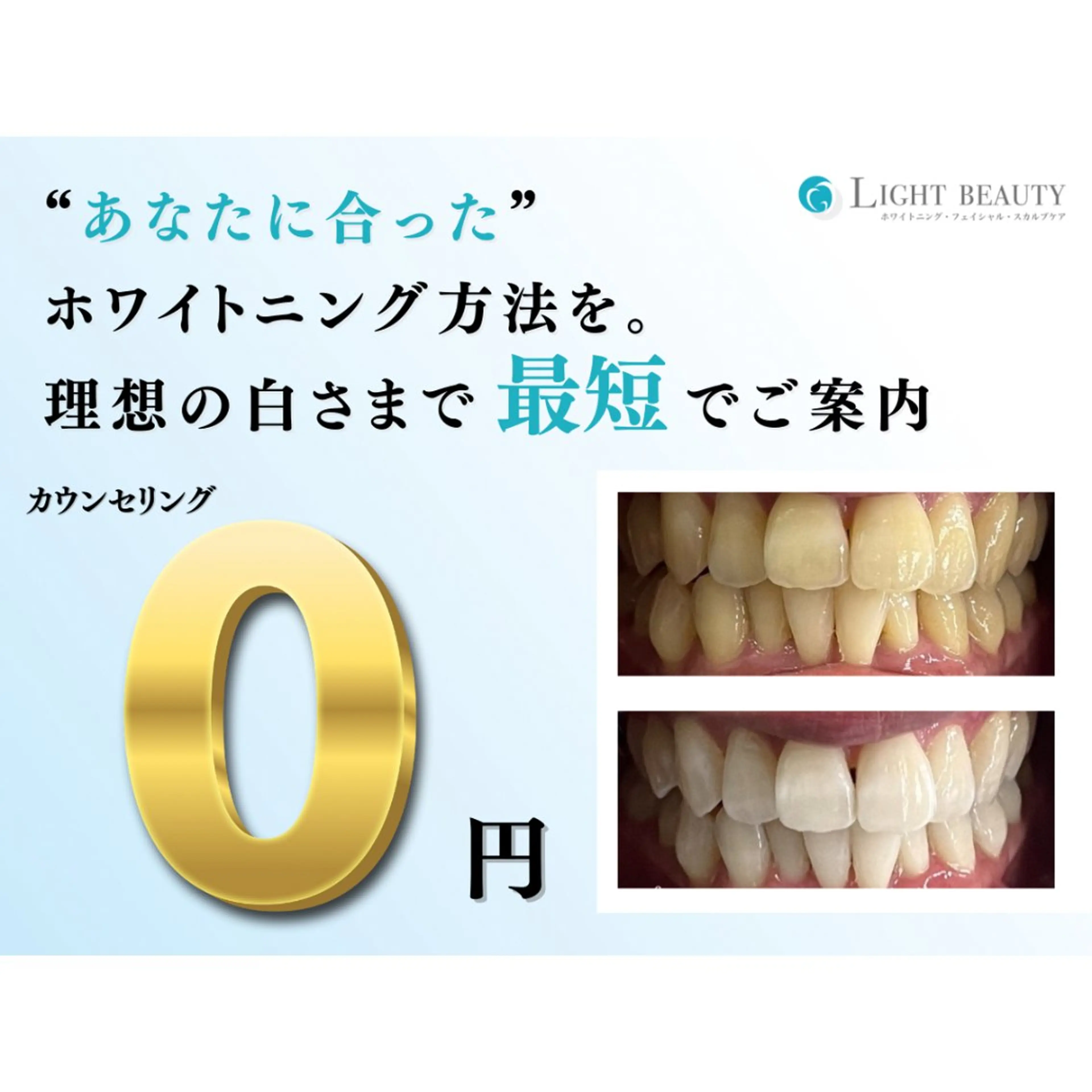 無料カウンセリングの写真