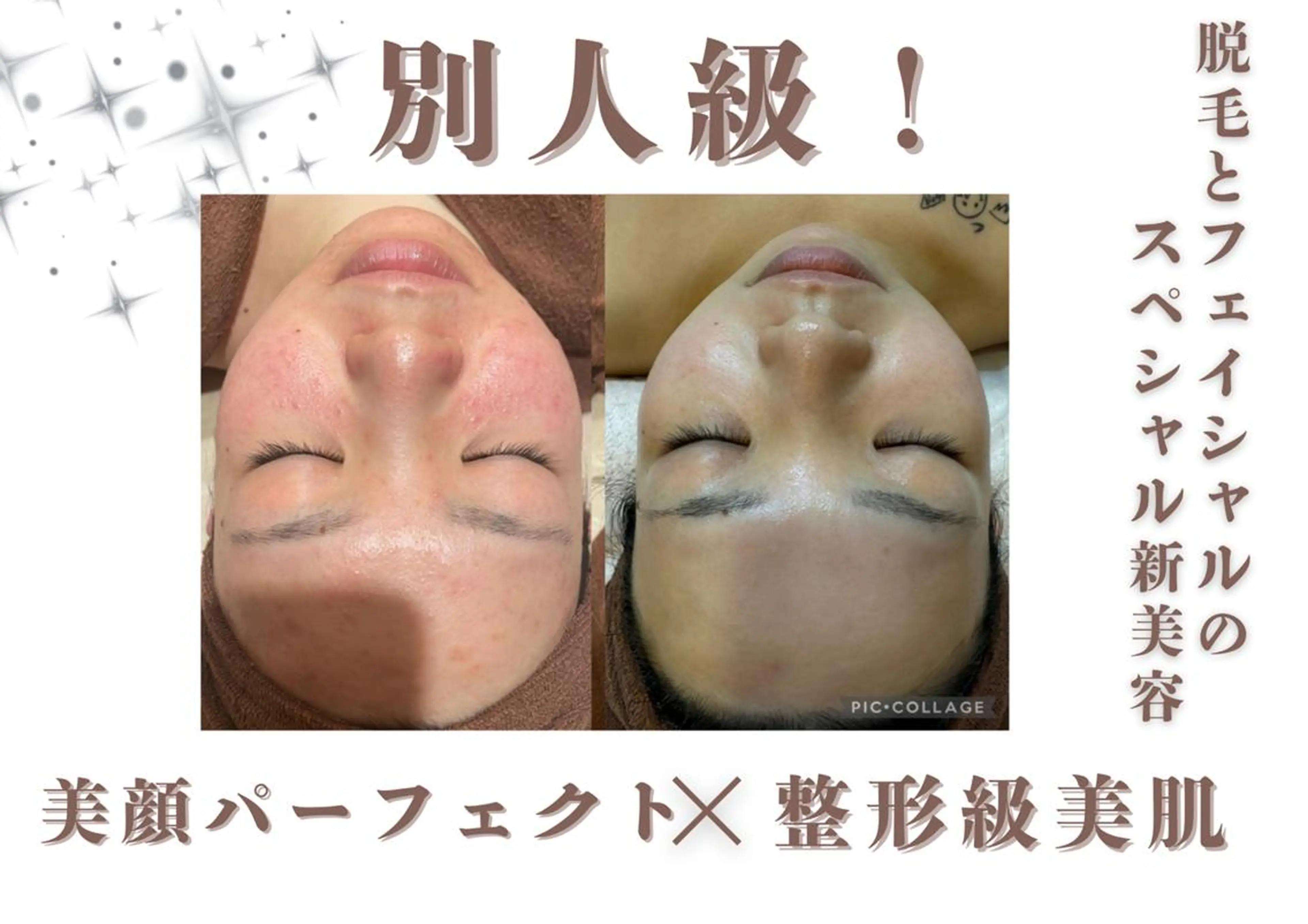 脱毛 創業40周年✨美肌サ ロンRAYVIS銀座のエステ・リラクイメージ