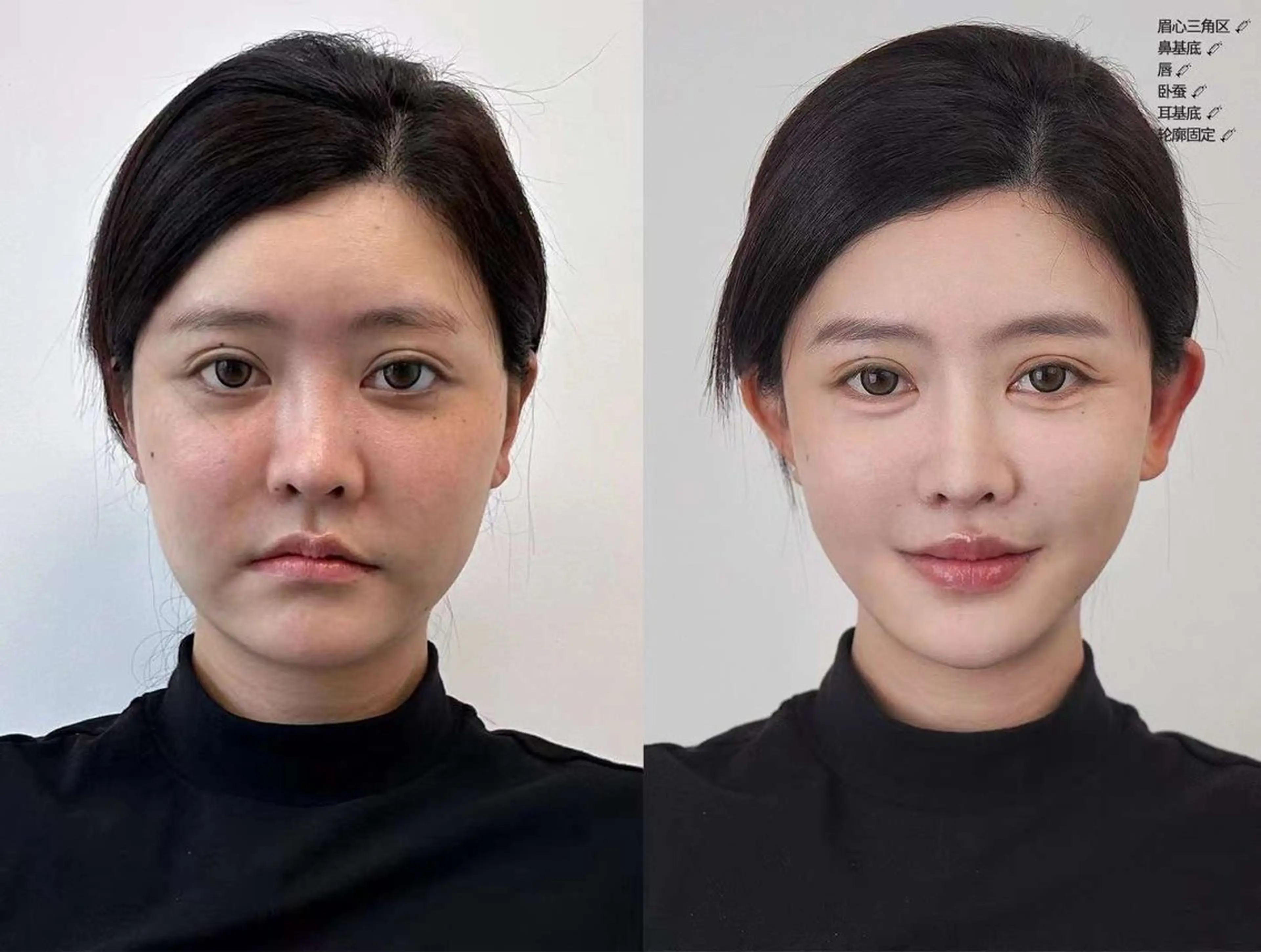 ネイル 韓国ネイル エステ aliaハイフ&水光ジェットサロン所属・aliaハーブ水光店 エステティシャン募集のエステ・リラクイメージ