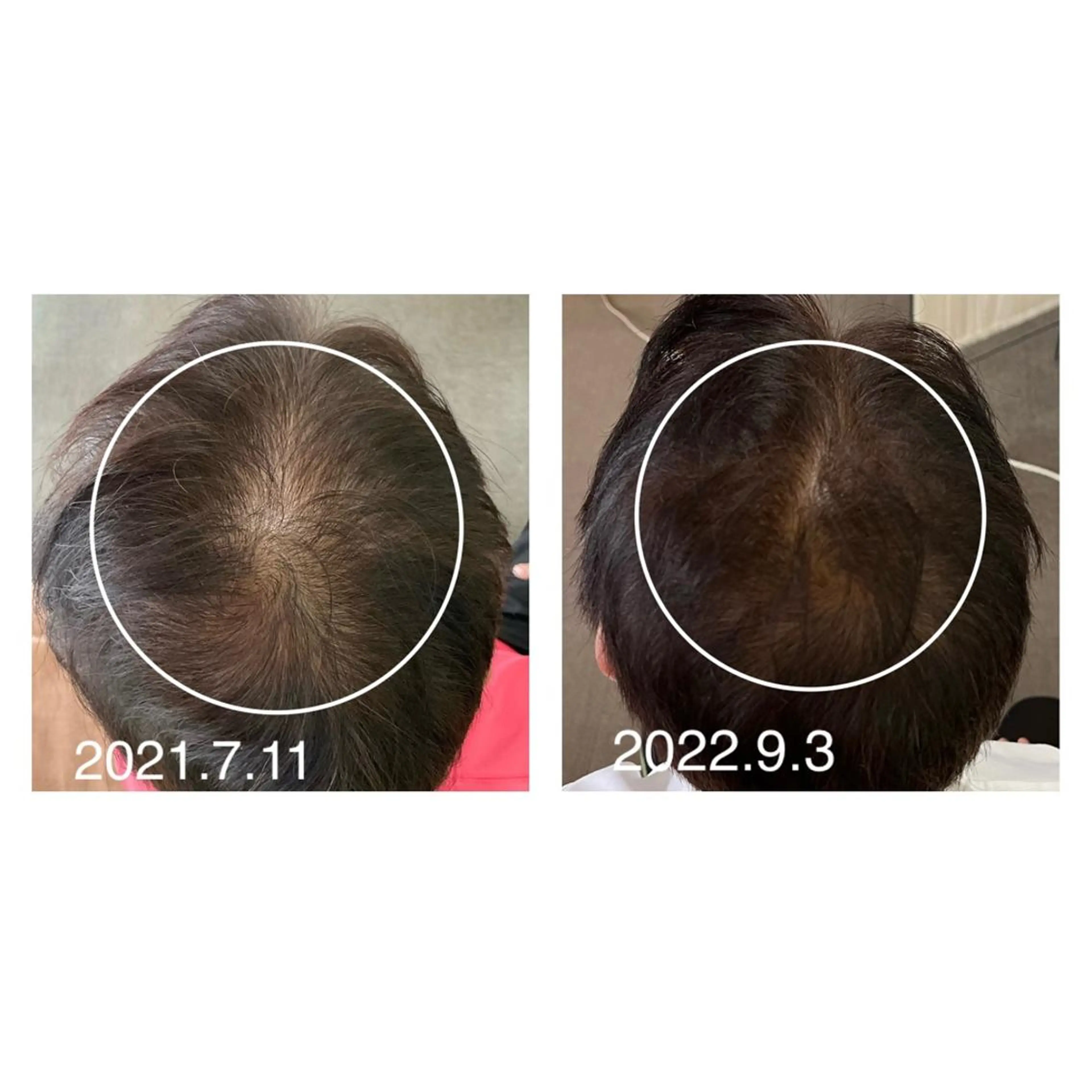 全身もみほぐし もみの樹のエステ・リラクイメージ