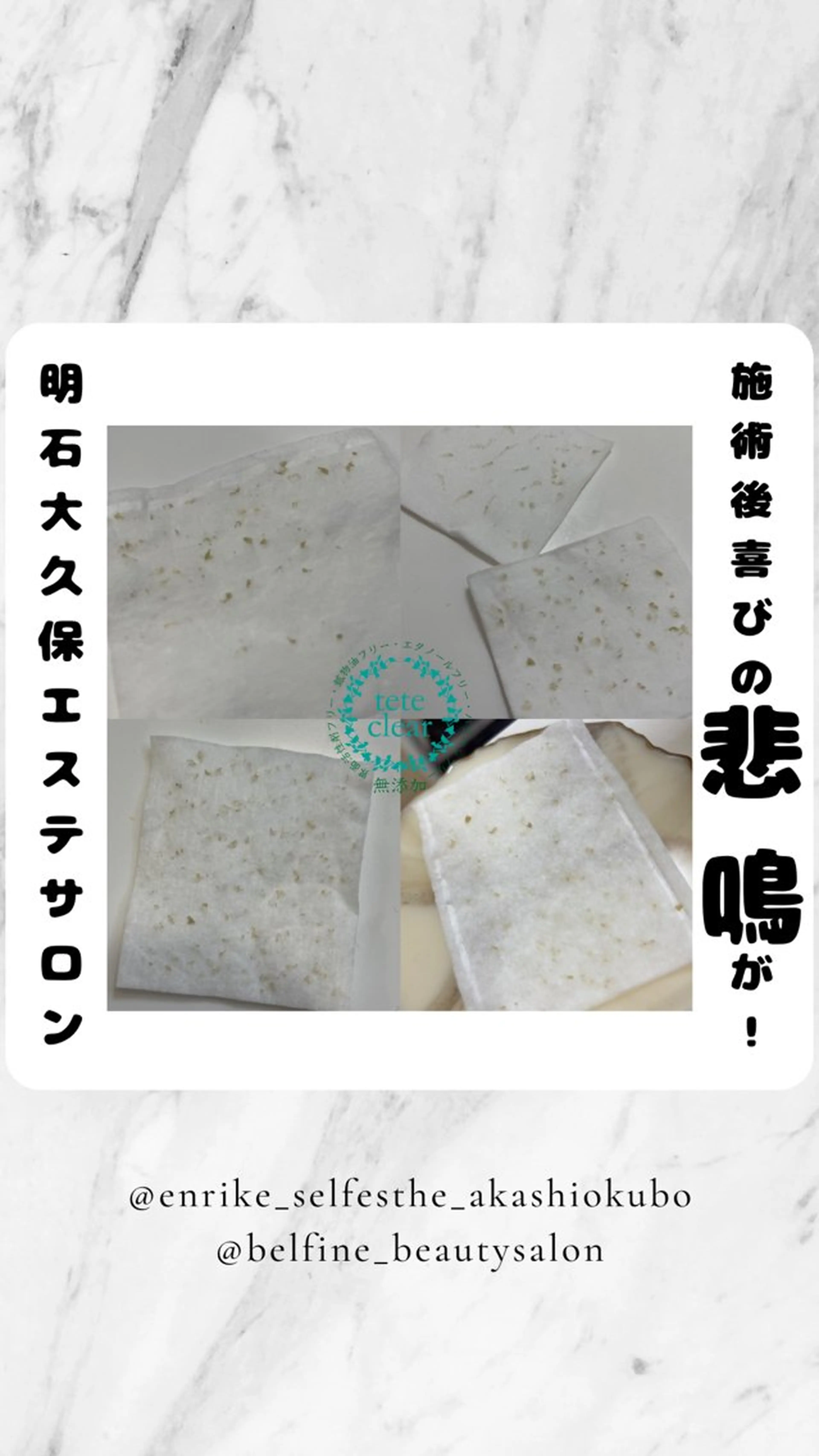 セルフエステエンリケ明石大久保店所属・夕希リンパ&痩身& 脱毛&毛穴ケアのエステ・リラクイメージ