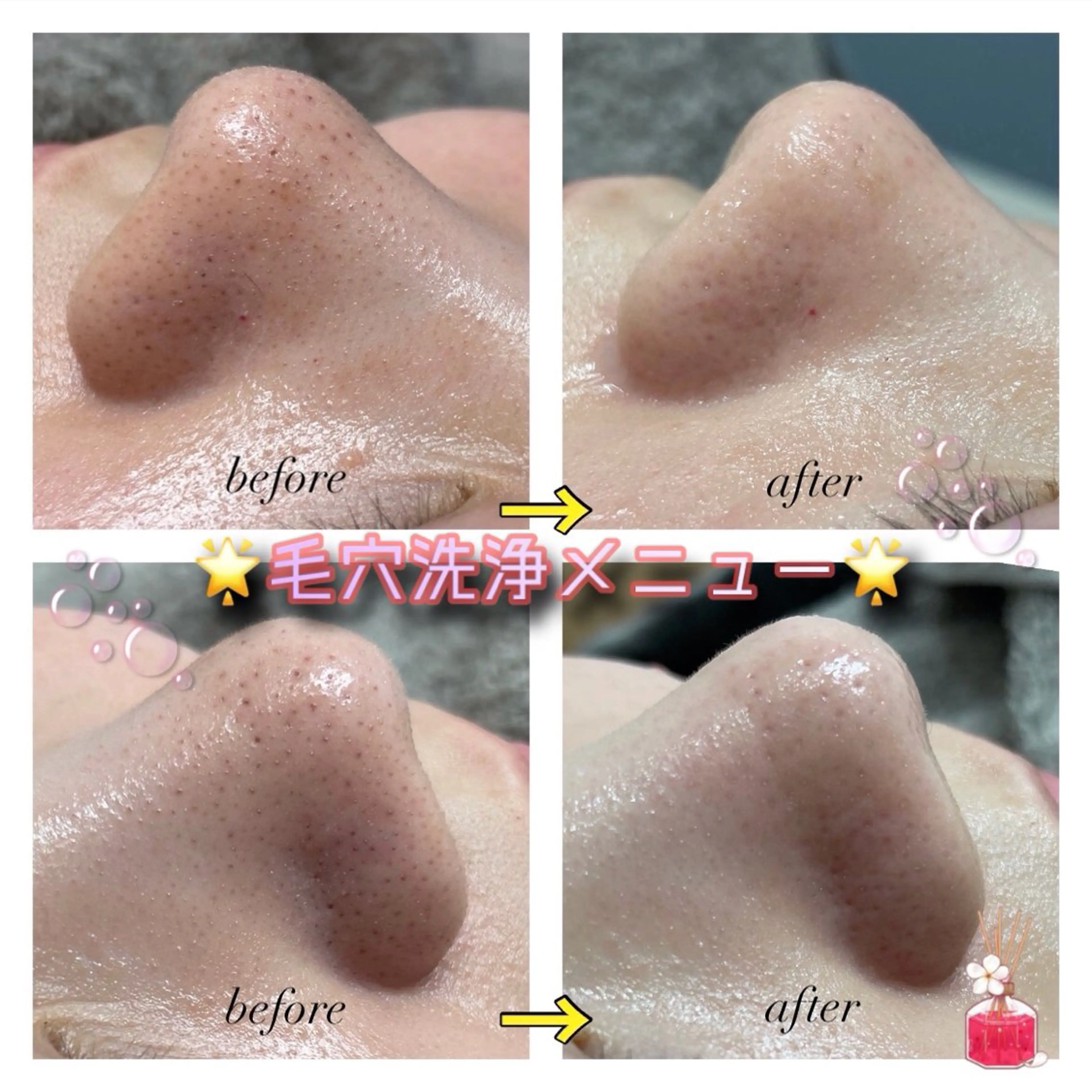 Beryl ベリルのマツエク・マツパデザイン