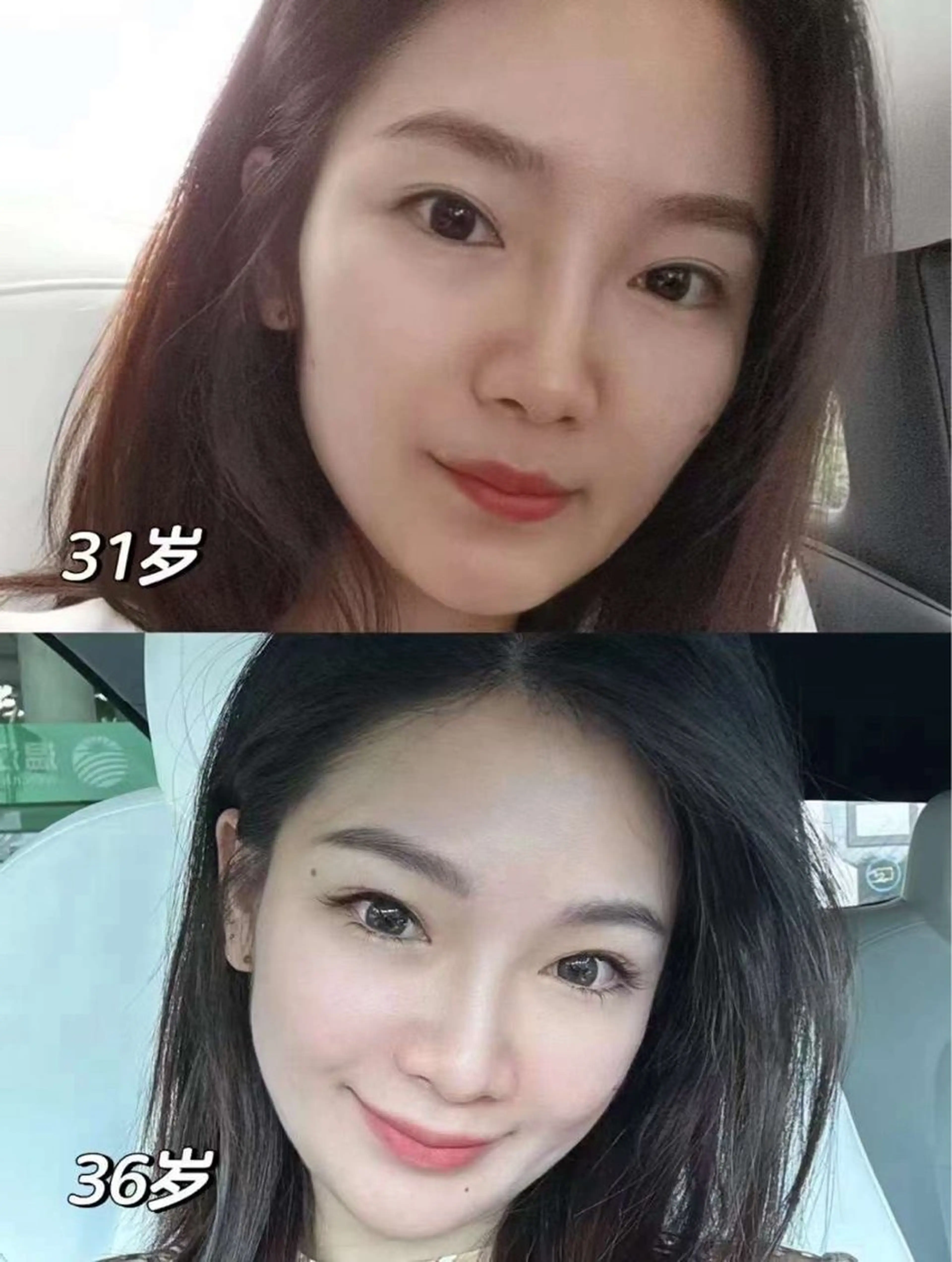 ネイル エステ aliaハイフ&水光ジェットサロン所属・aliaハーブ水光店 エステティシャン募集のエステ・リラクイメージ