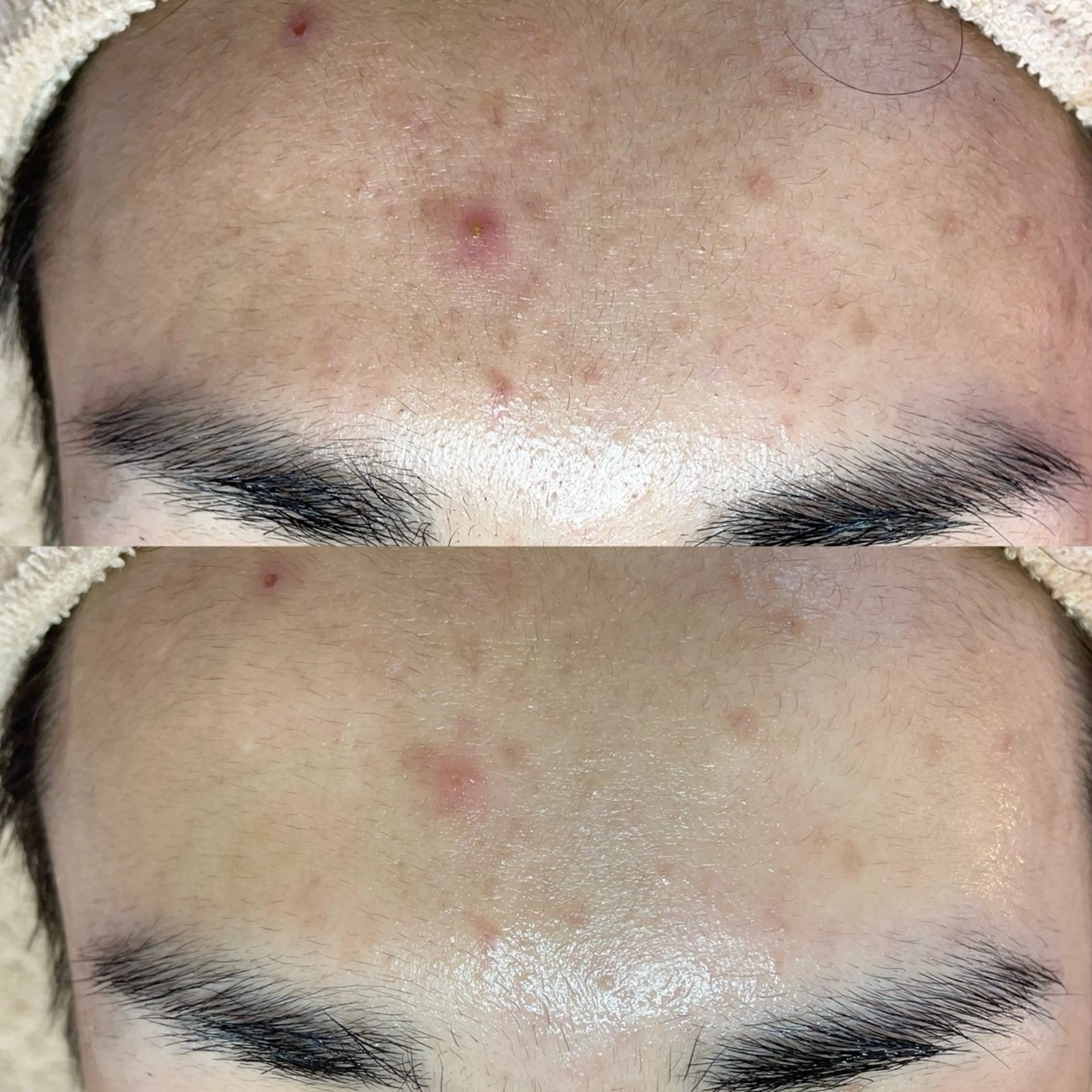 毛穴専門店MeMe.八千代店所属・\毛穴・頭皮/ のお悩みに特化💪のその他イメージ