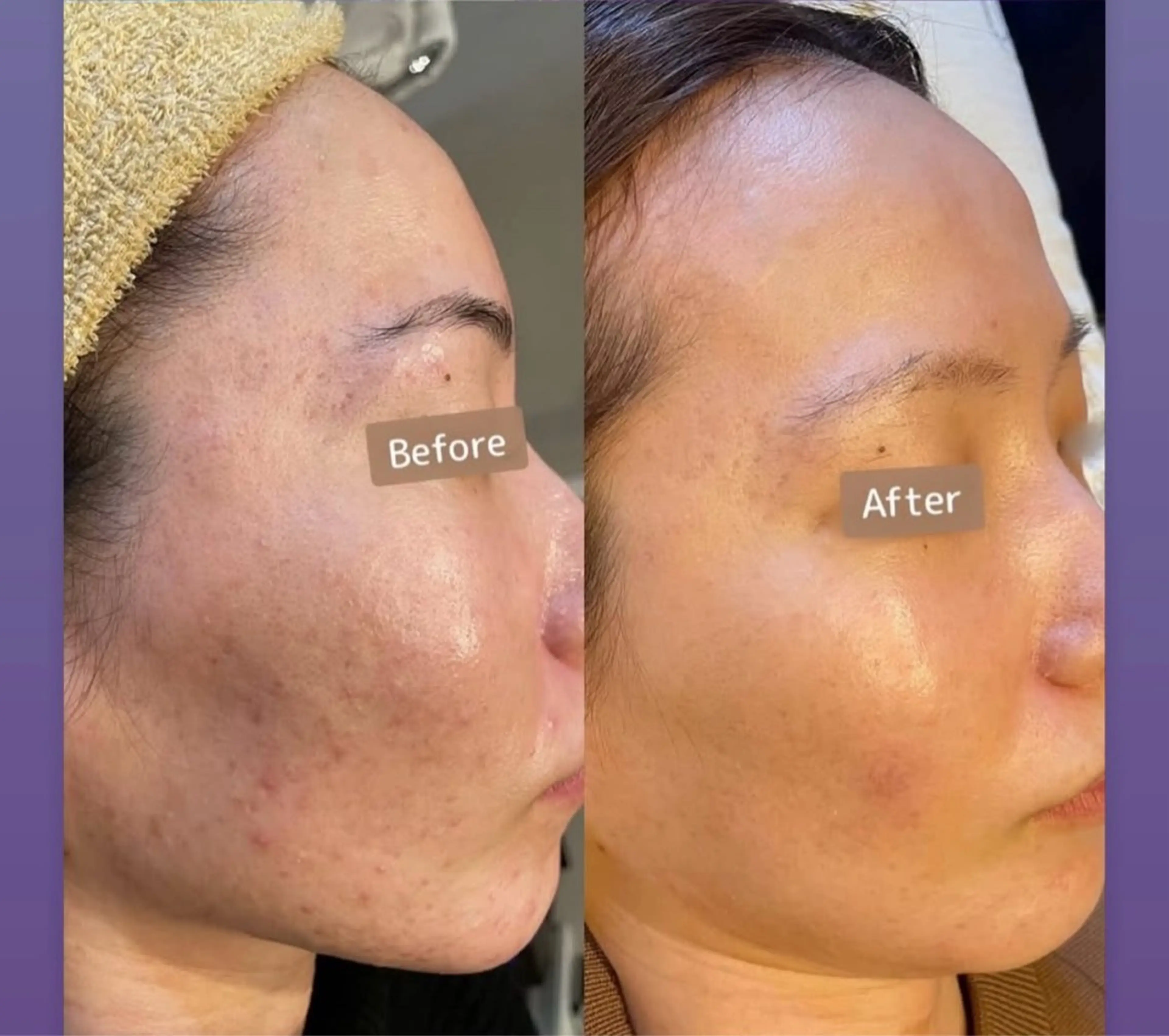 Blooming所属・LOUISE. ／肌質・頭皮のエステ・リラクイメージ