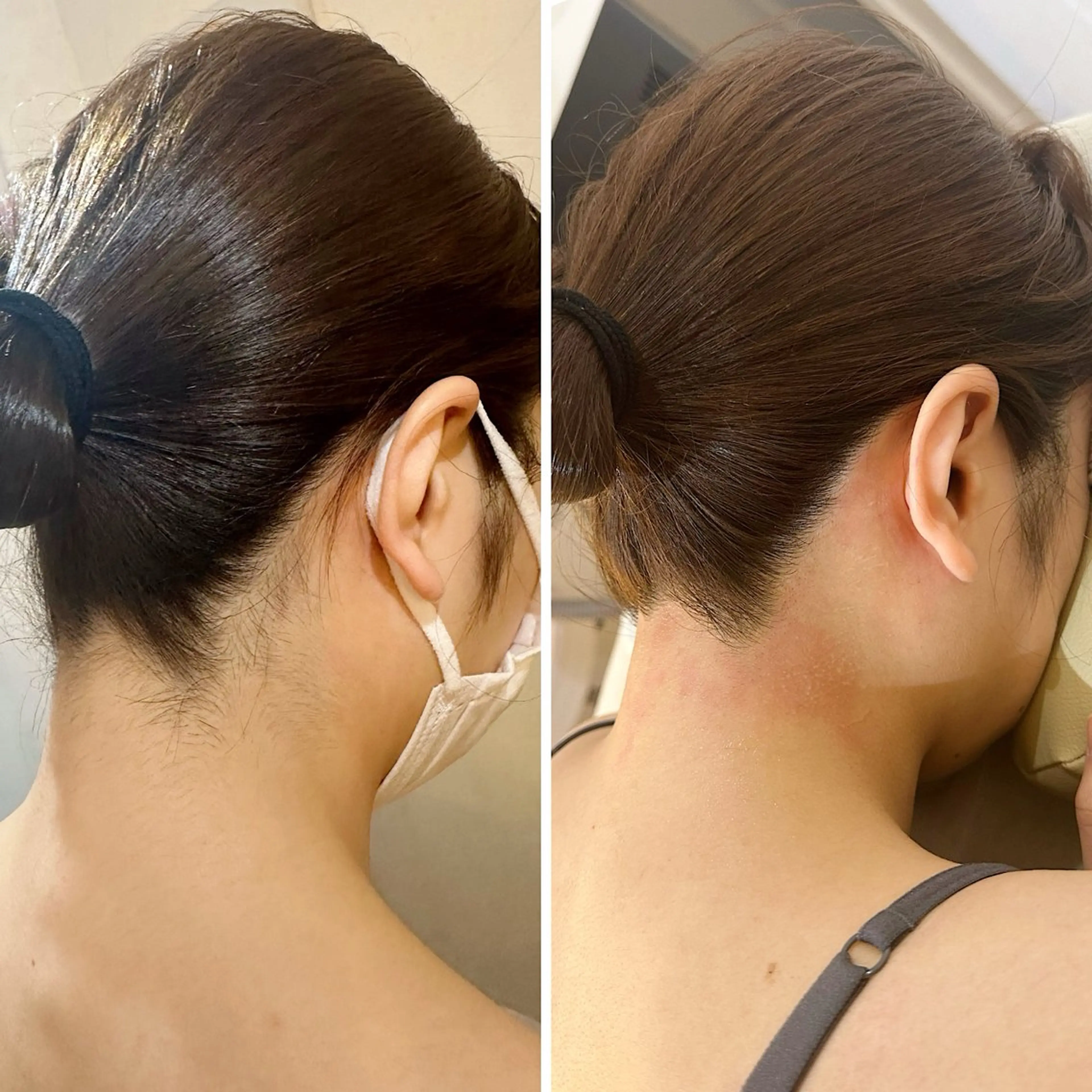 うなじ脱毛/美肌脱毛 LABELのエステ・リラクイメージ