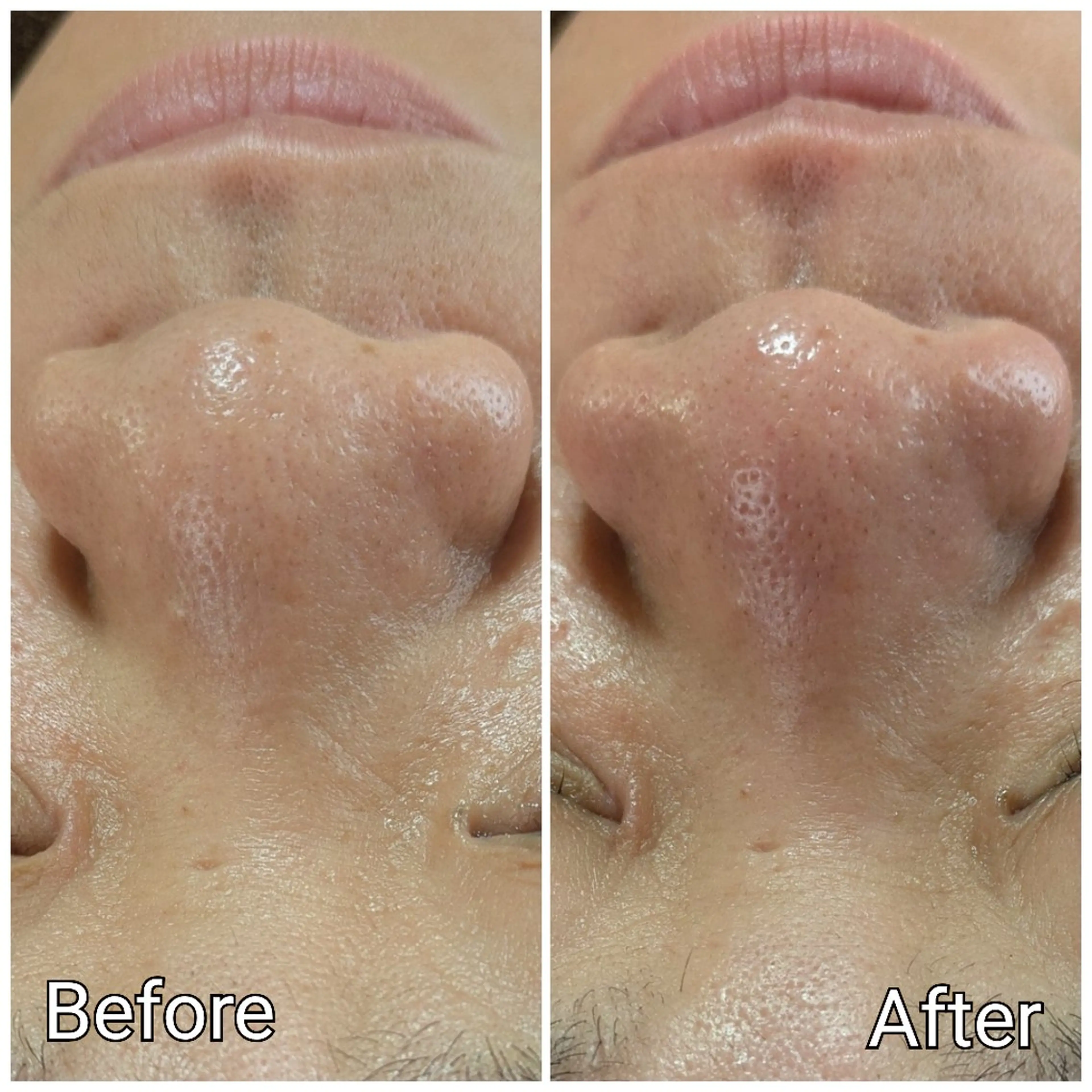 エステ 山城 悠菜のエステ・リラクイメージ