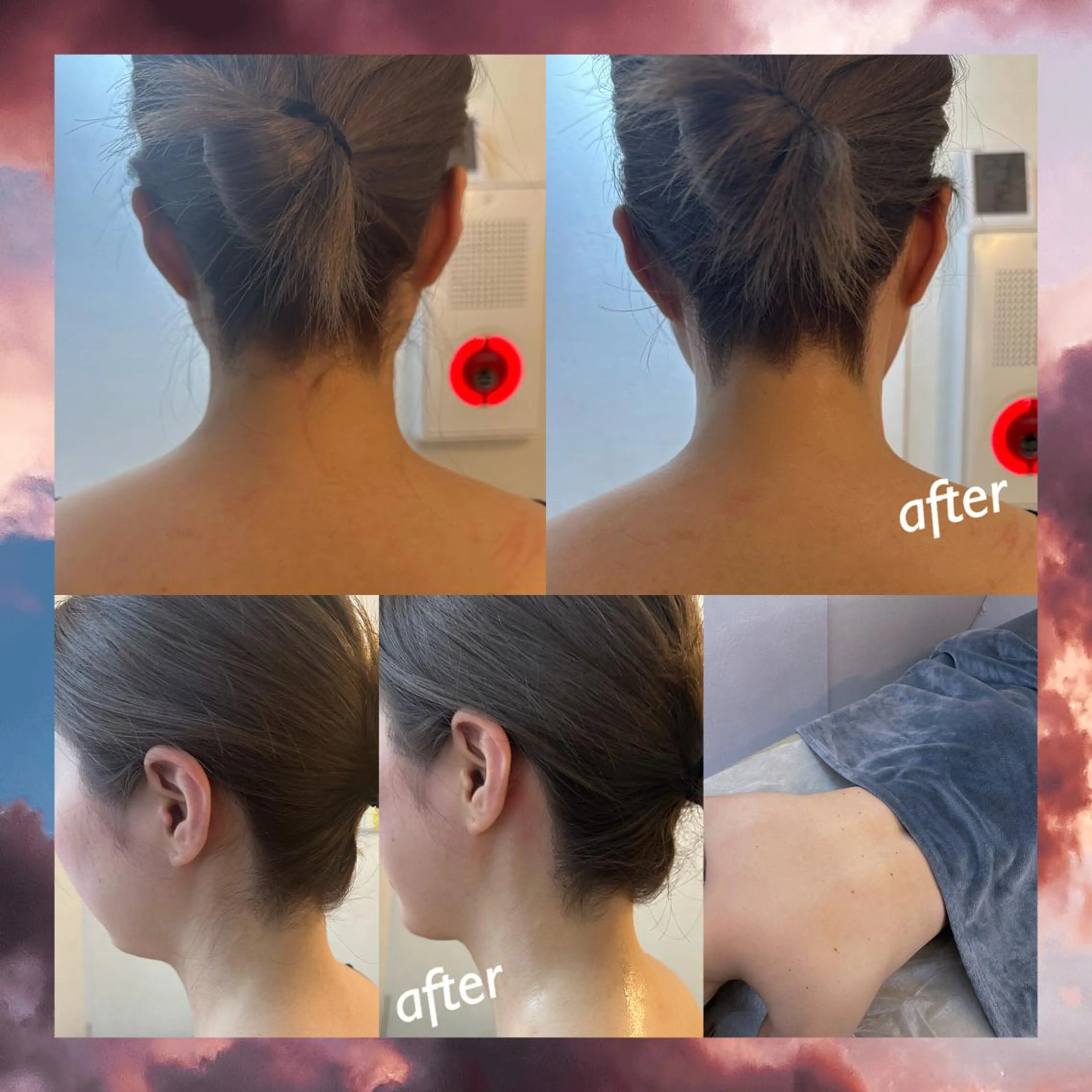 脱毛 うなじ脱毛/美肌脱毛 LABELのエステ・リラクイメージ