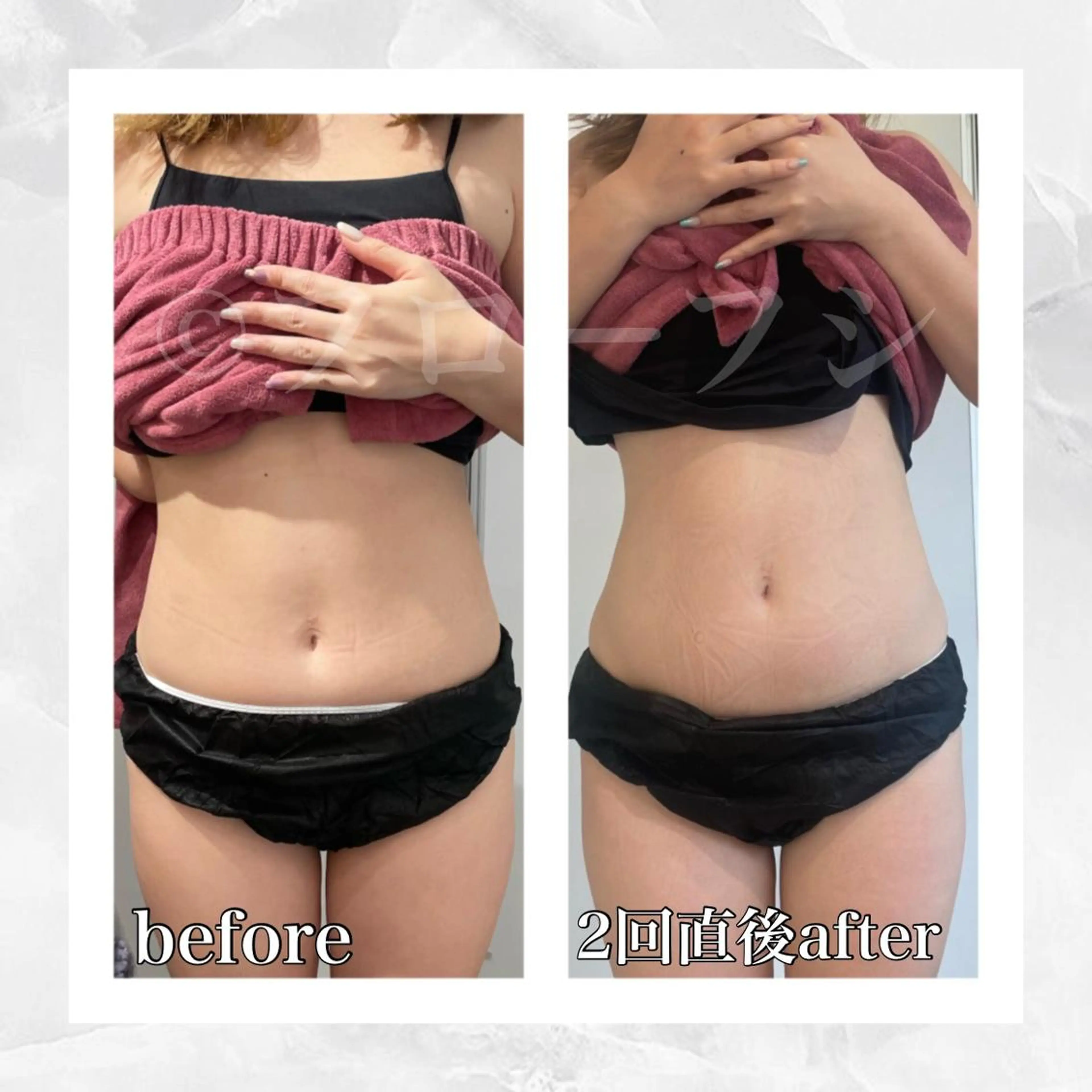 エステ リラク 部分痩せ♥️小顔専門 MIKUのエステ・リラクイメージ