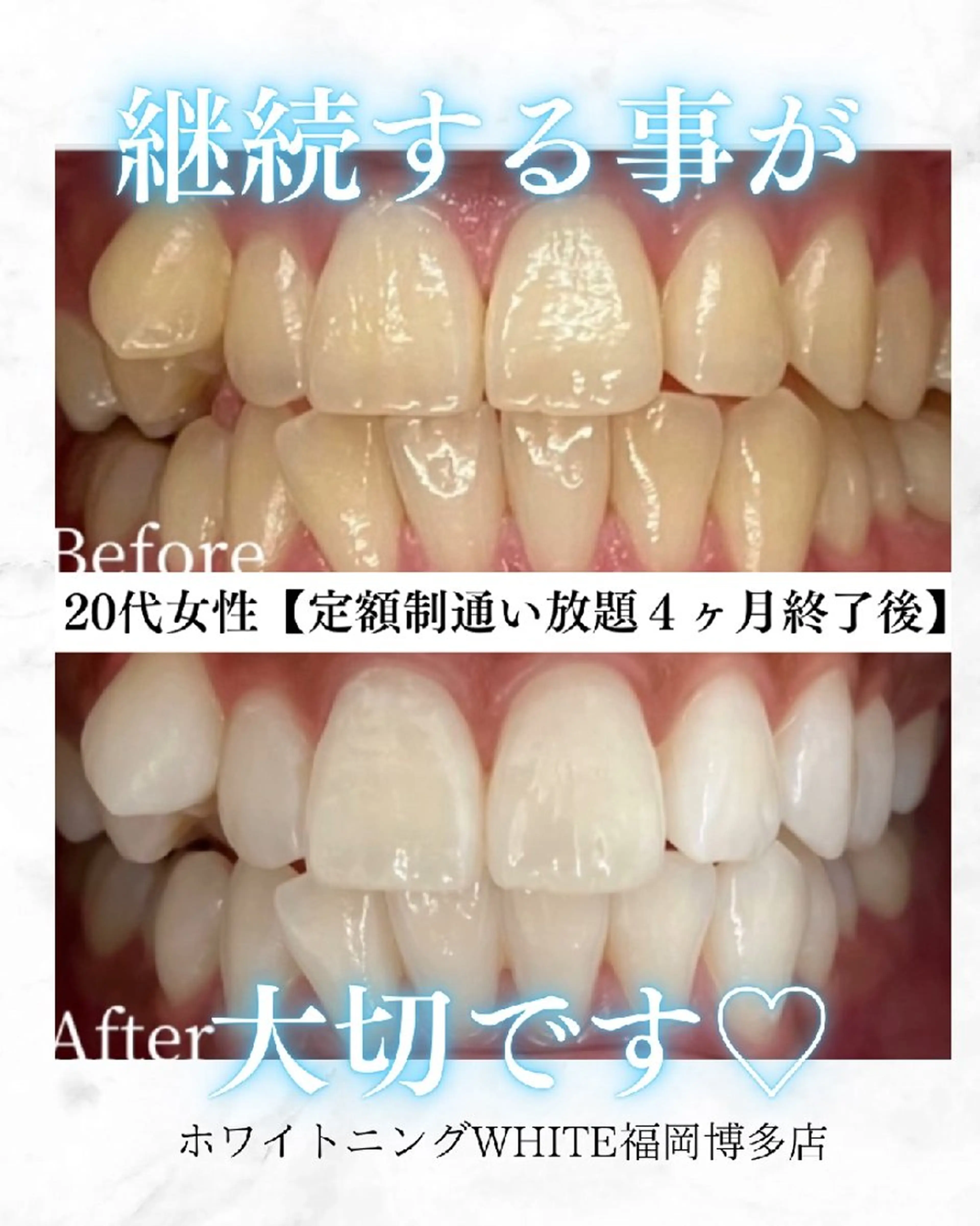 メンズ キッズ エステ リラク ホワイトニングサロン WHITE福岡博多店のエステ・リラクイメージ