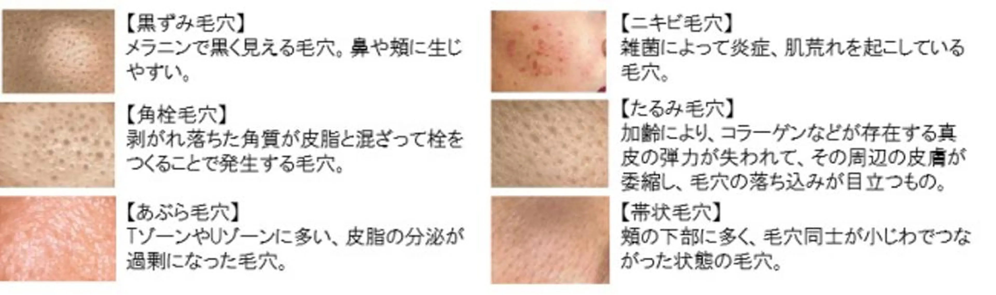 SESUNNY セサニー SEIRAのマツエク・マツパデザイン