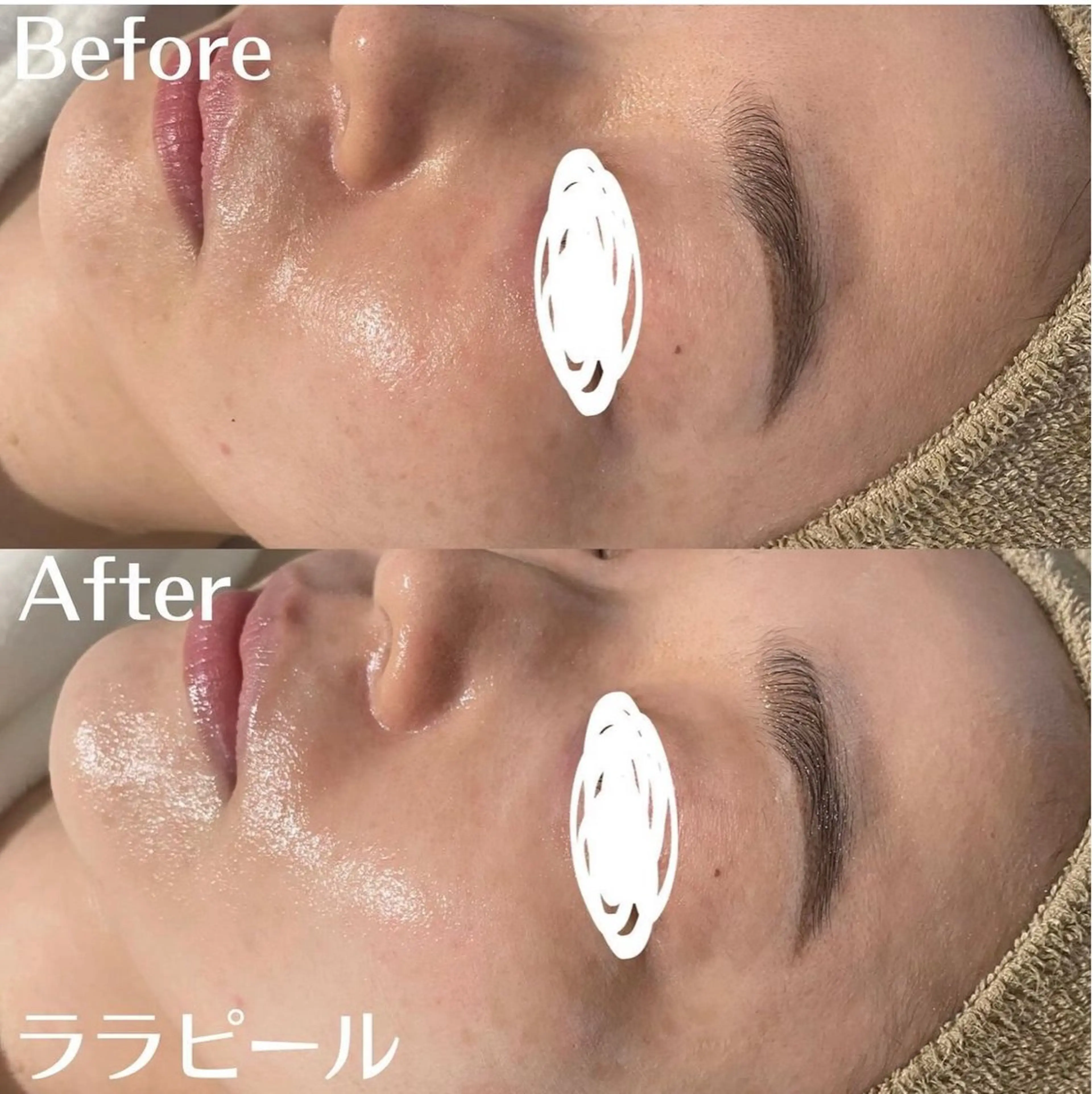 中目黒ハーブピーリン グ🌿ララピールのエステ・リラクイメージ