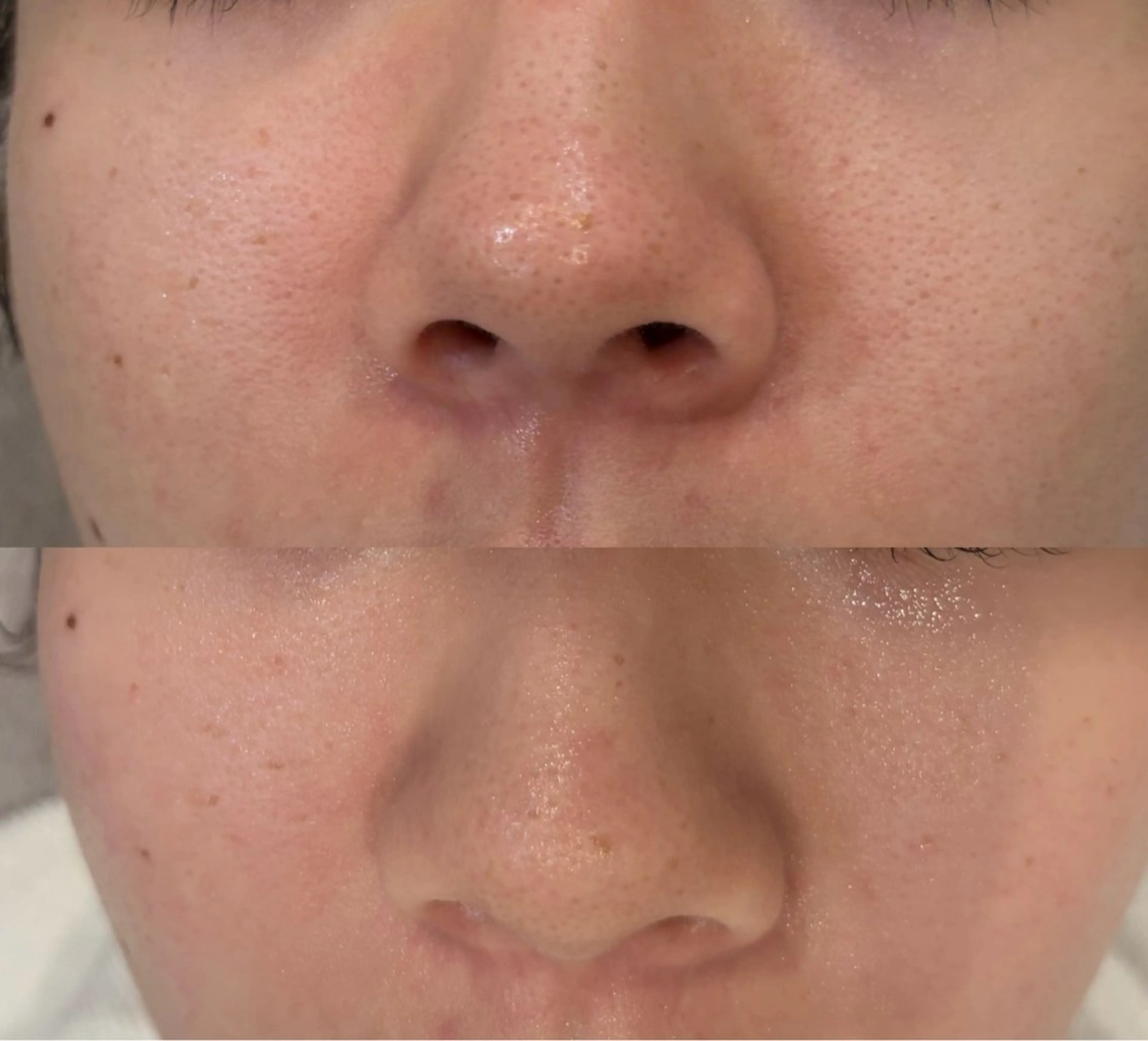 エステ DeI'm   名古屋栄所属・小林 玲菜のエステ・リラクイメージ