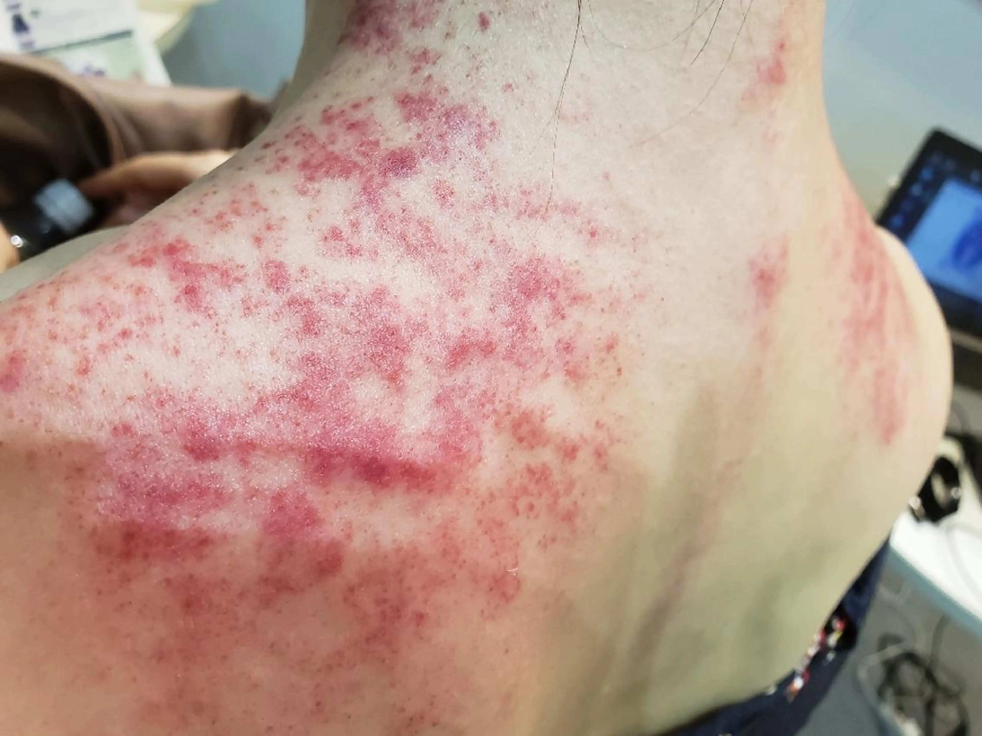 波動サロン ララ 刈谷のエステ・リラクイメージ